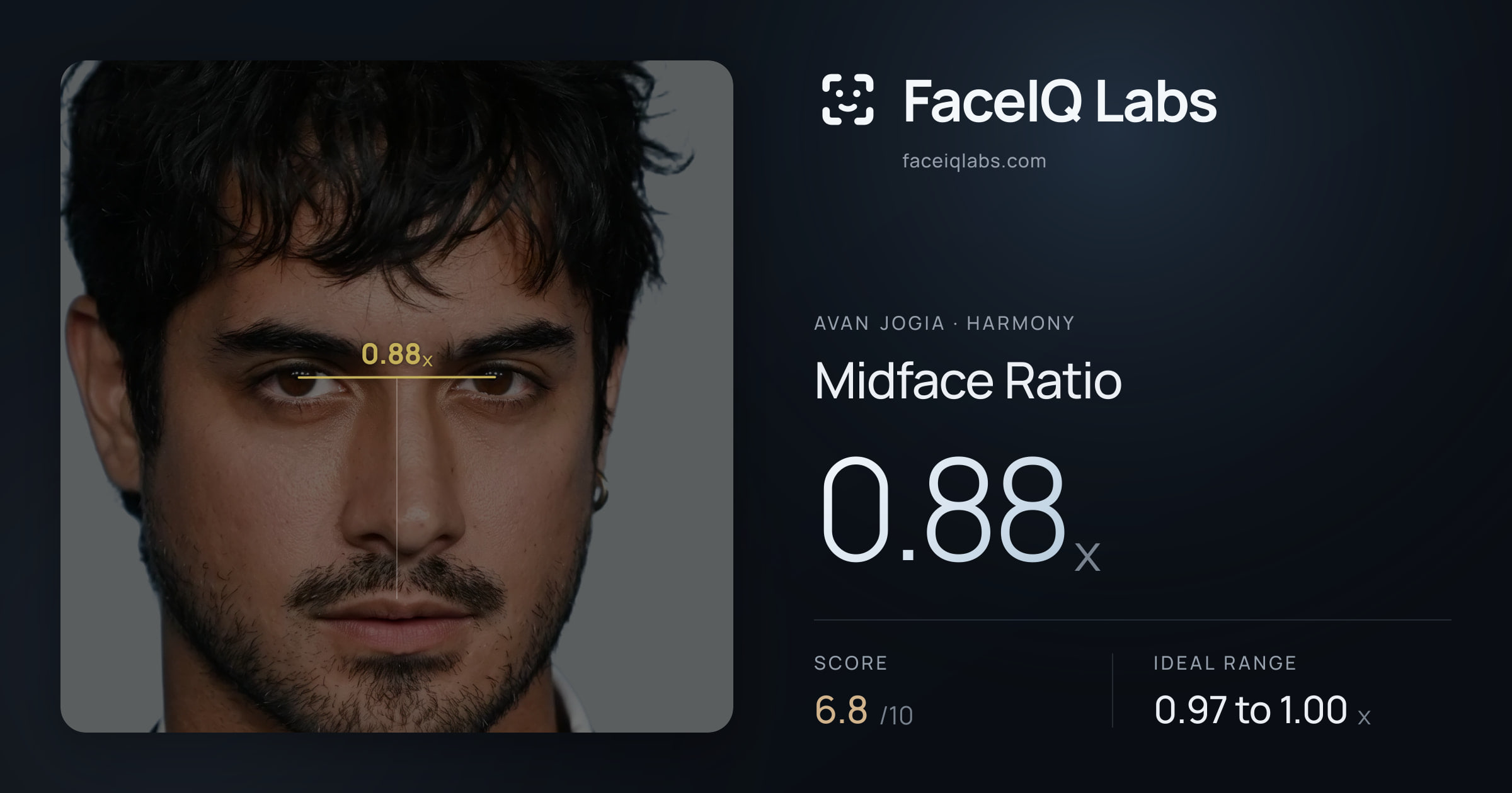 Avan Jogia Midface Ratio: 0.88x, drawn on the photo