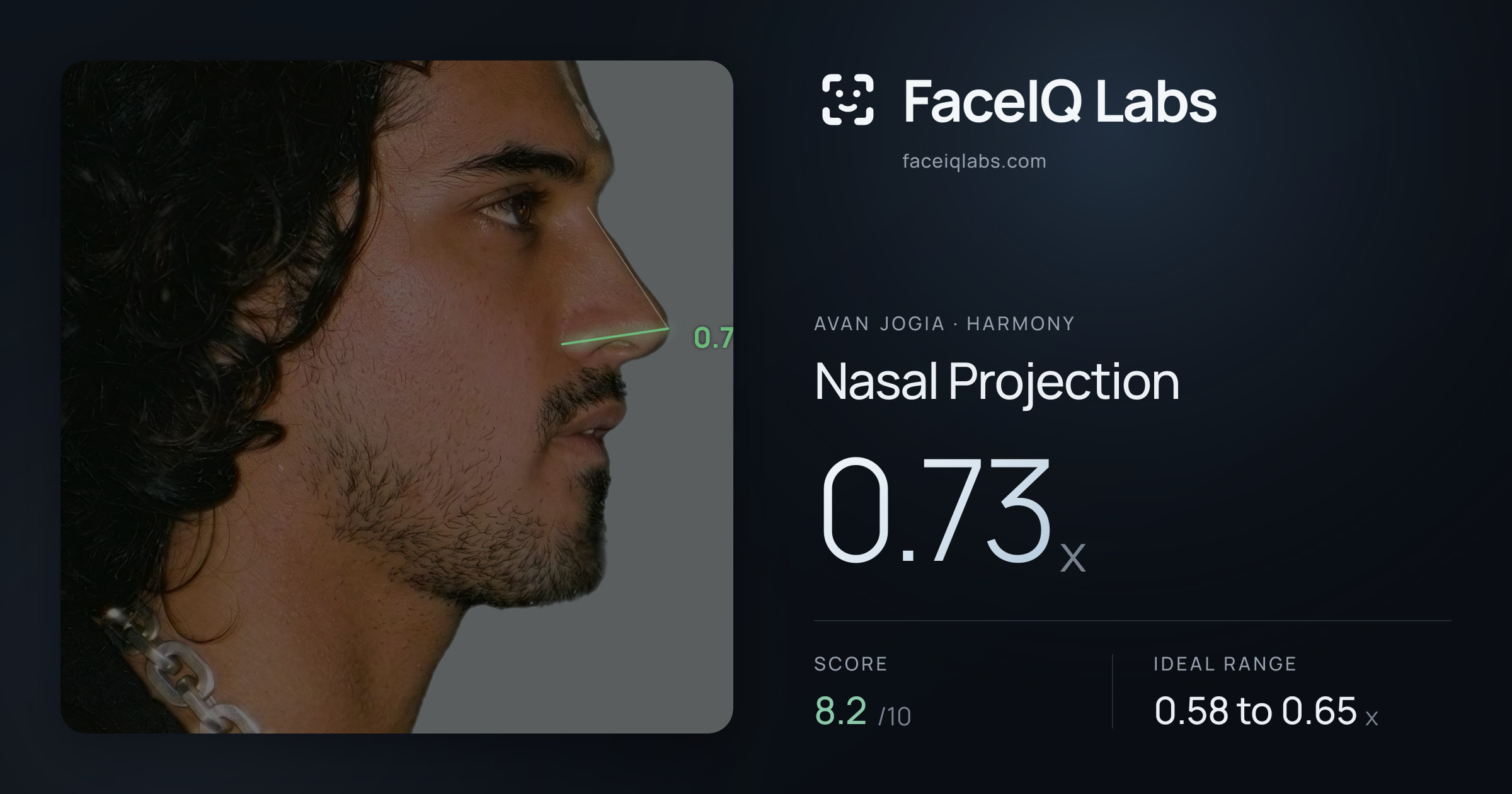 Avan Jogia Nasal Projection: 0.73x, drawn on the photo