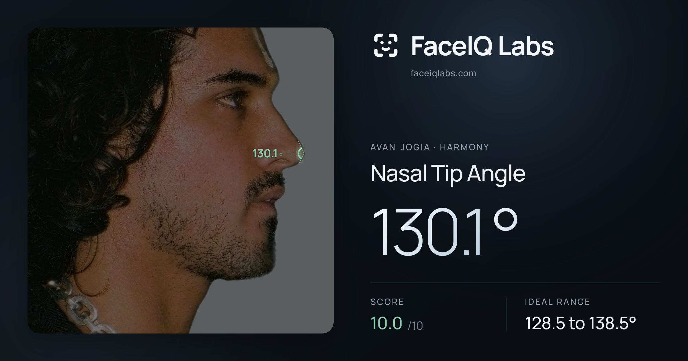 Avan Jogia Nasal Tip Angle: 130.1°, drawn on the photo