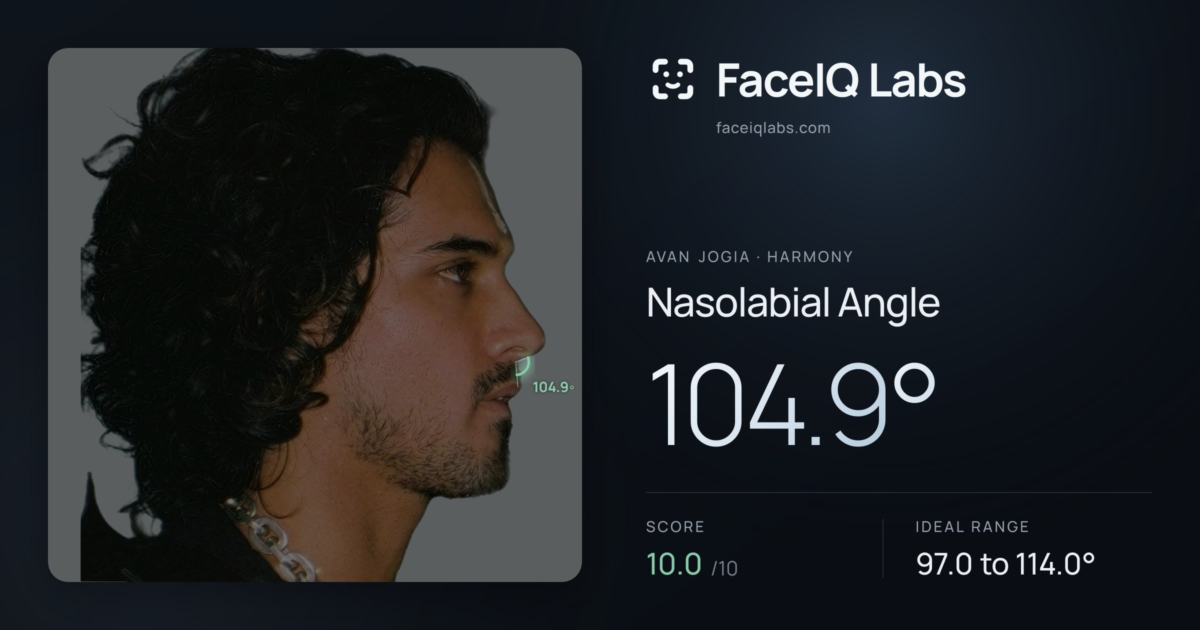 Avan Jogia Nasolabial Angle: 104.9°, drawn on the photo
