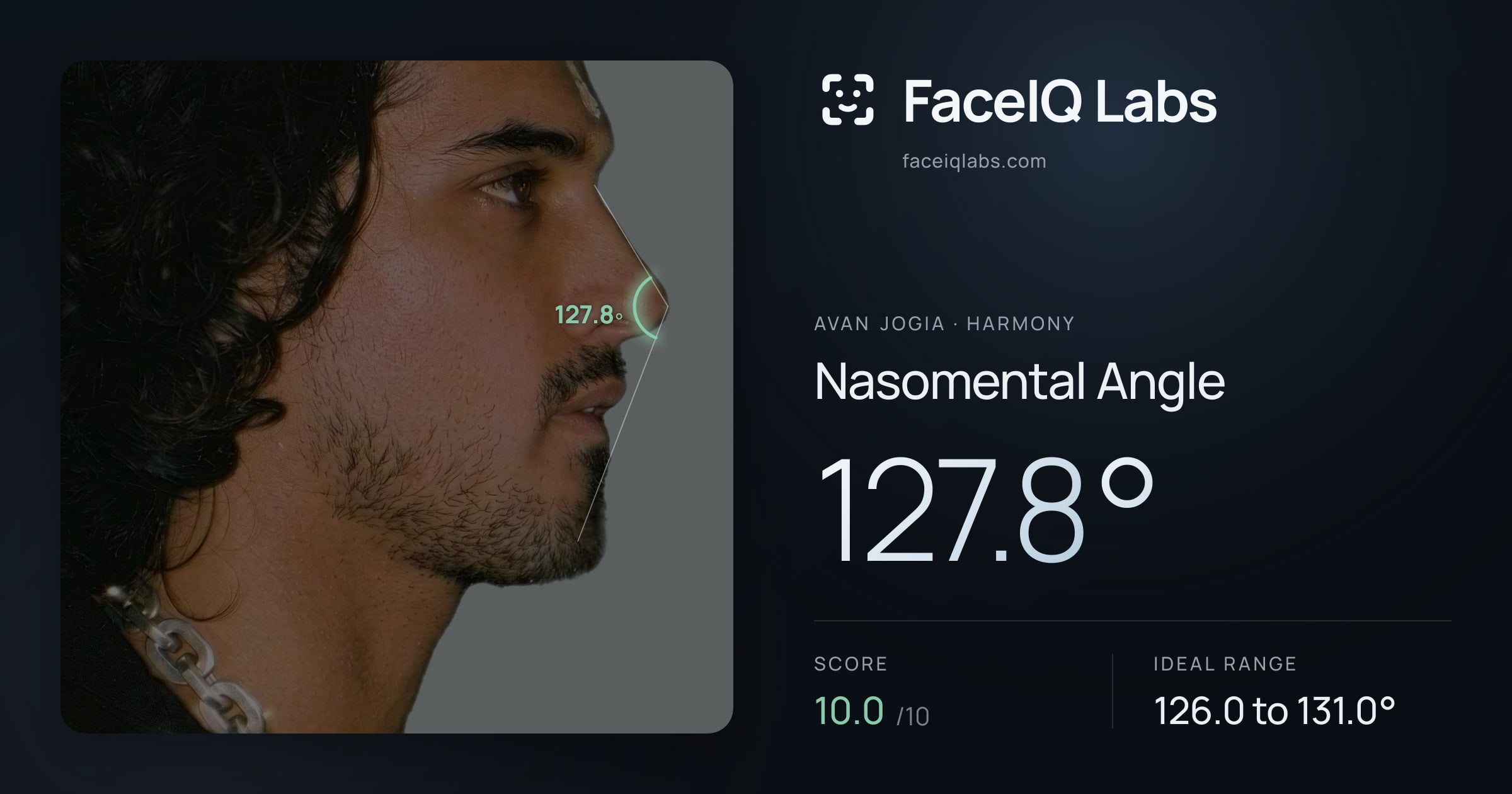 Avan Jogia Nasomental Angle: 127.8°, drawn on the photo