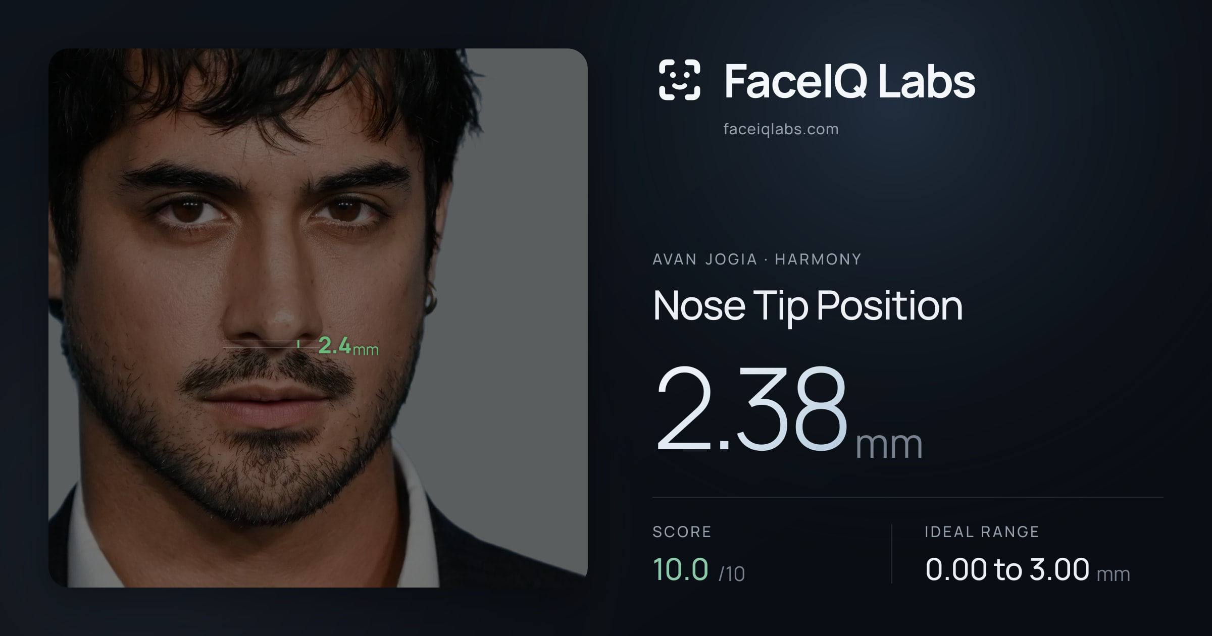 Avan Jogia Nose Tip Position: 2.38mm, drawn on the photo