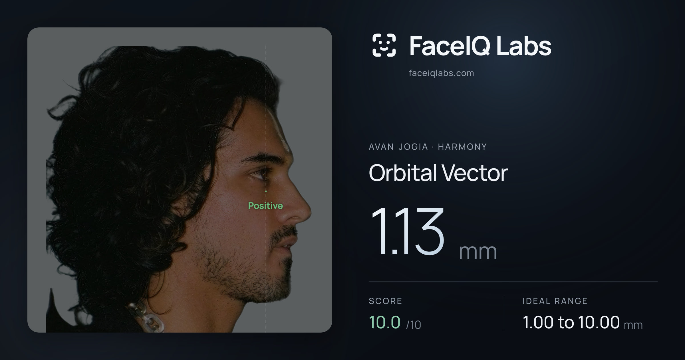 Avan Jogia Orbital Vector: 1.13mm, drawn on the photo