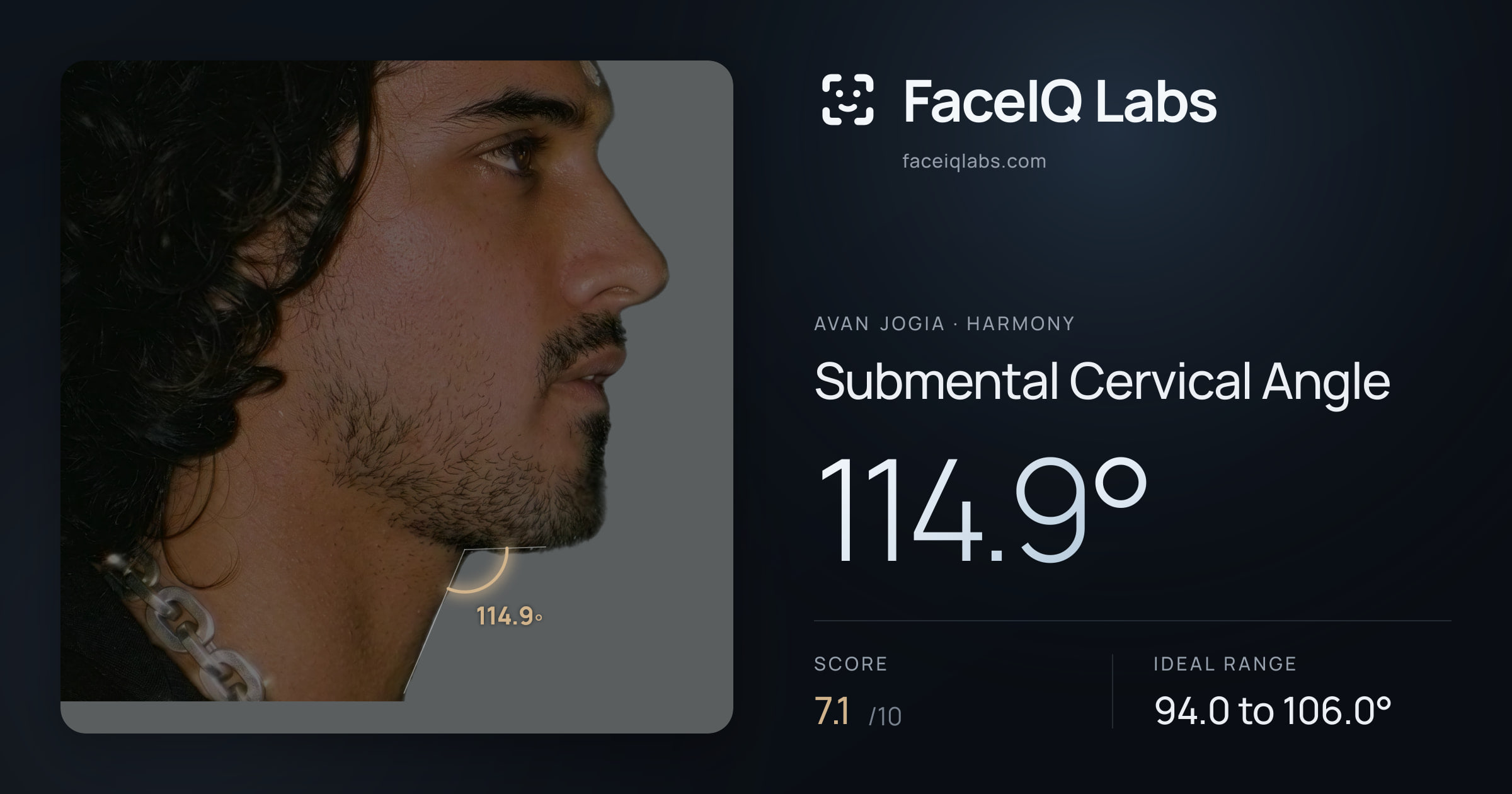 Avan Jogia Submental Cervical Angle: 114.9°, drawn on the photo
