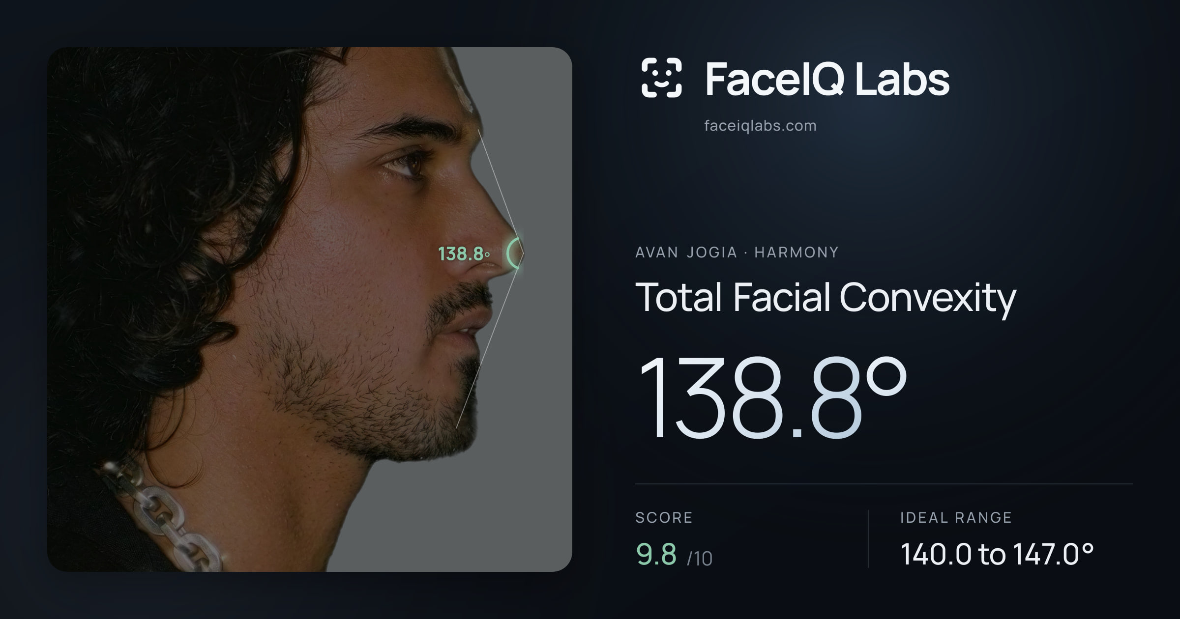 Avan Jogia Total Facial Convexity: 138.8°, drawn on the photo
