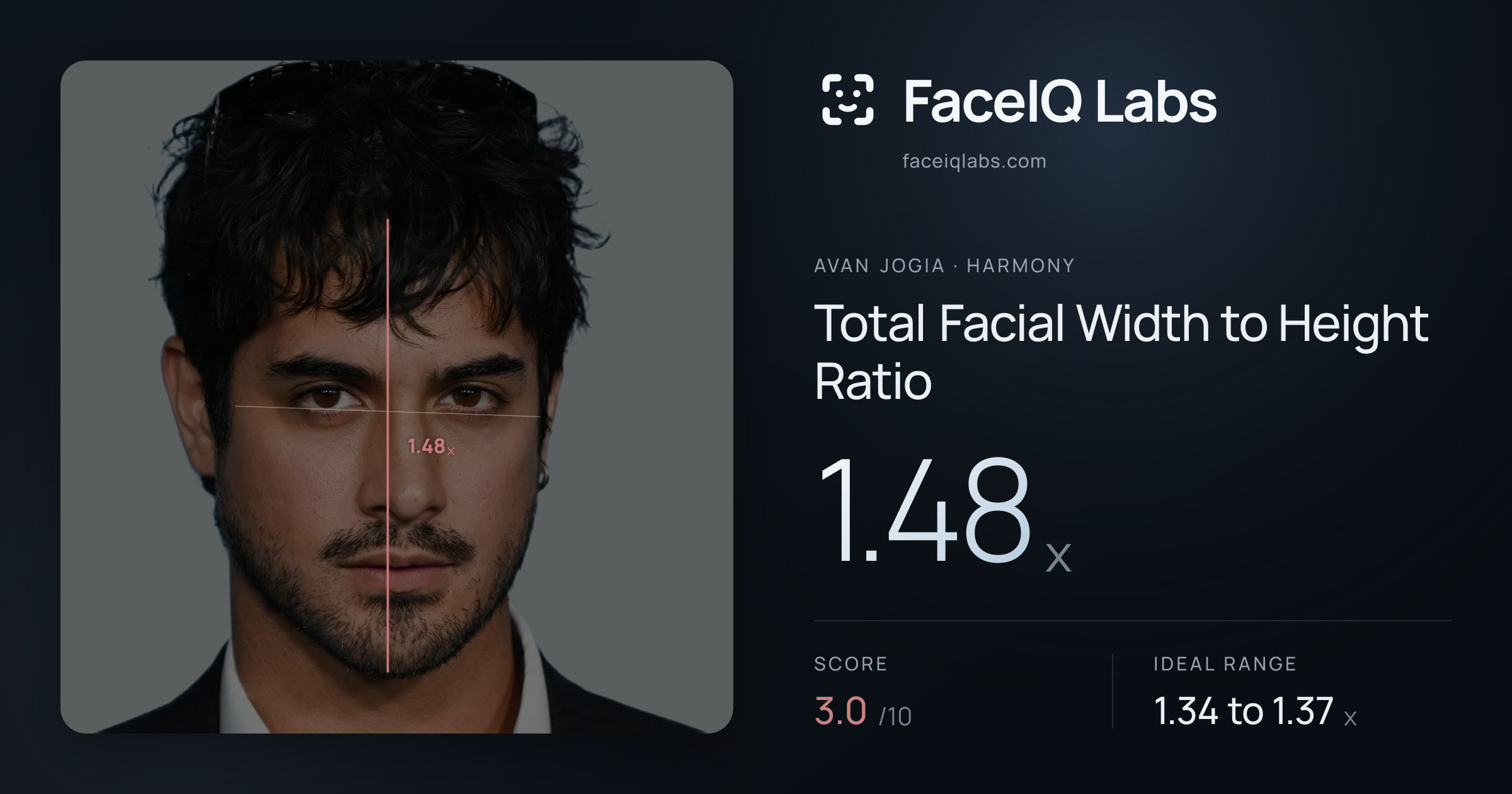 Avan Jogia Total Facial Width to Height Ratio: 1.48x, drawn on the photo