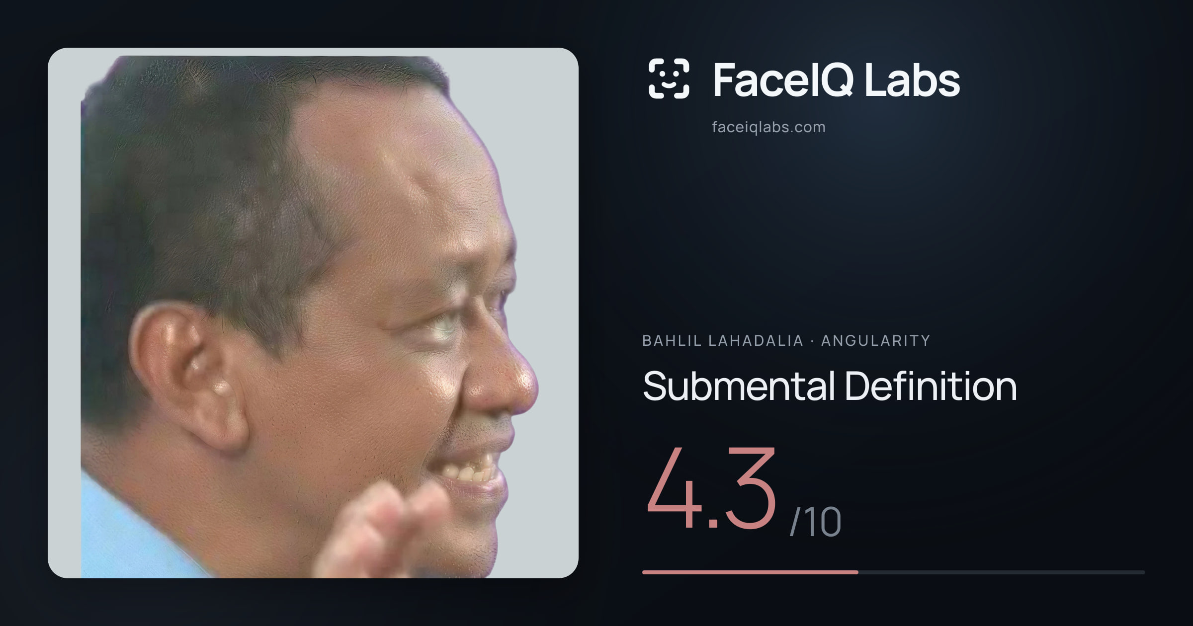 Bahlil Lahadalia Submental Definition: 4.3/10, drawn on the photo
