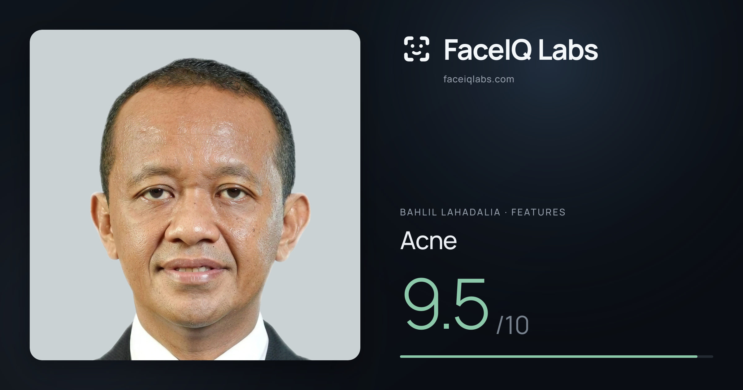 Bahlil Lahadalia Acne: 9.5/10, drawn on the photo