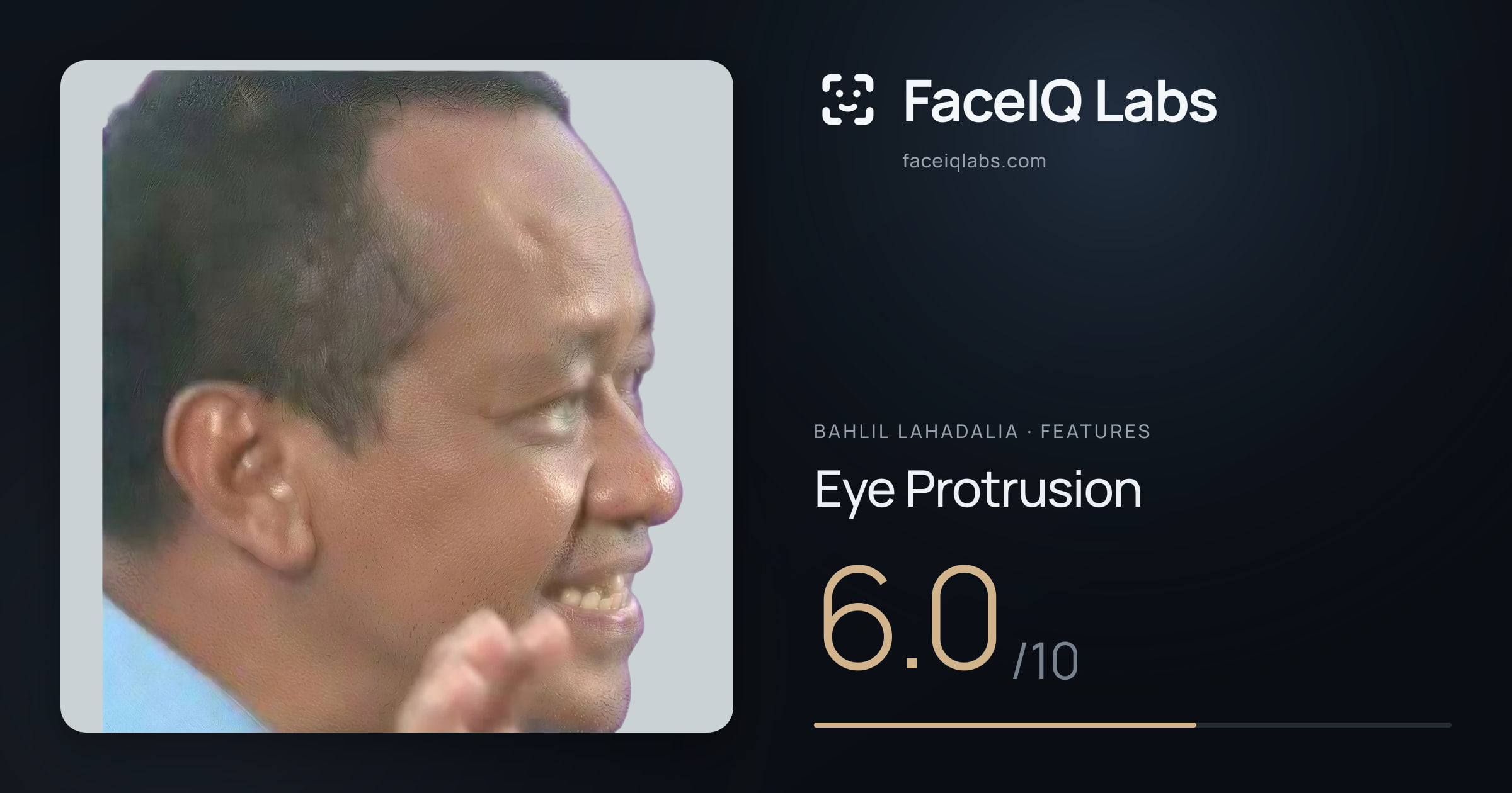 Bahlil Lahadalia Eye Protrusion: 6.0/10, drawn on the photo