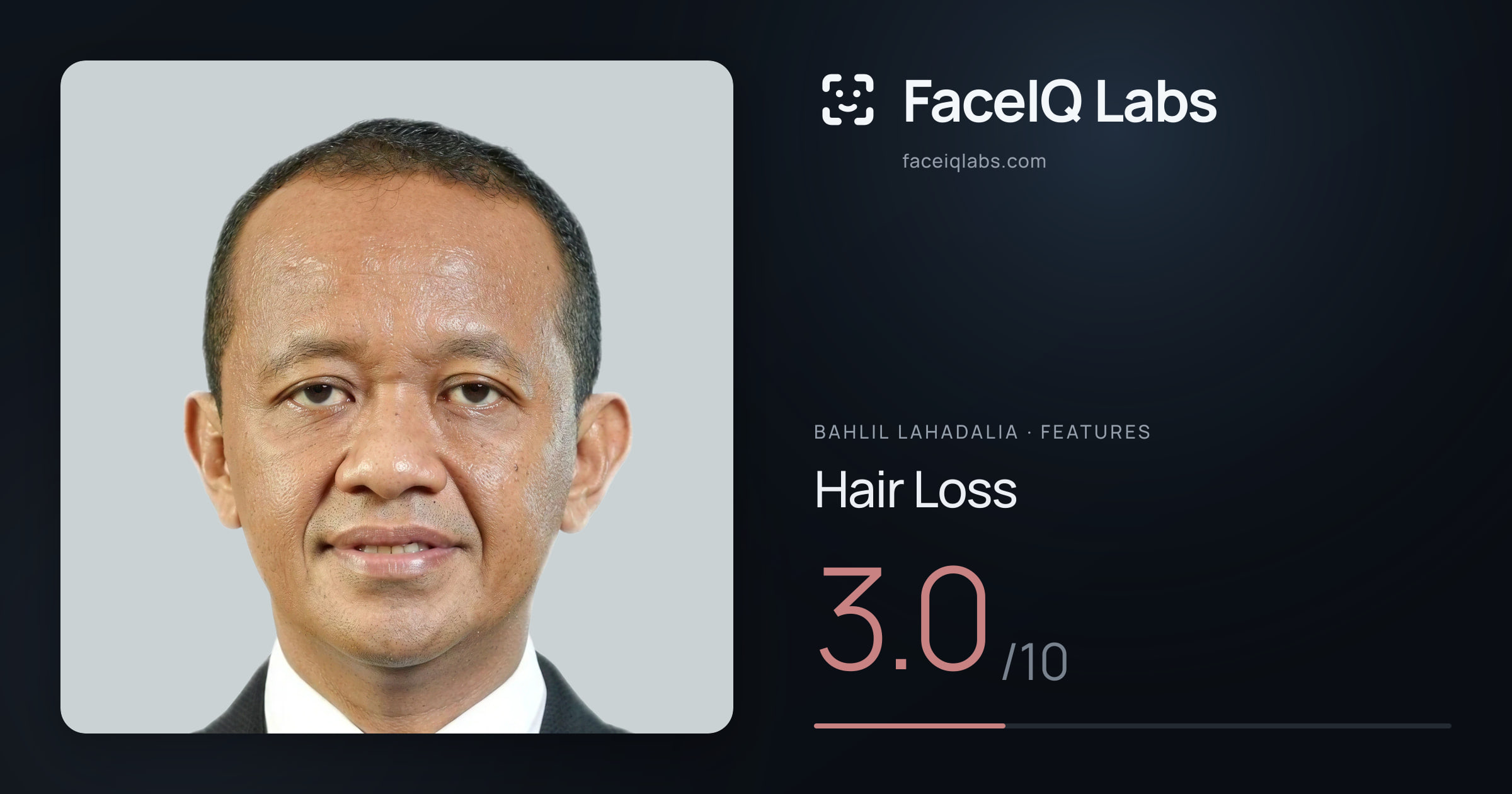 Bahlil Lahadalia Hair Loss: 3.0/10, drawn on the photo