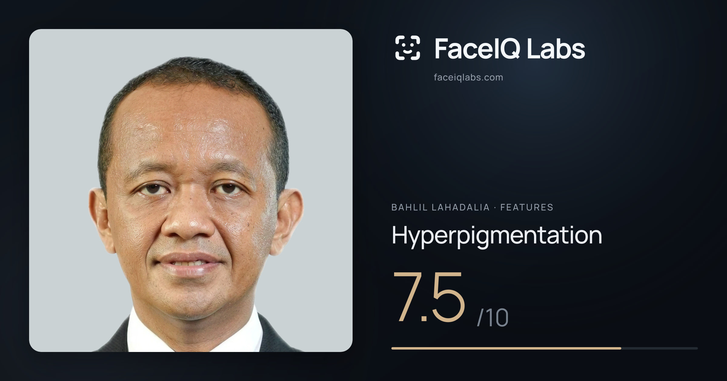 Bahlil Lahadalia Hyperpigmentation: 7.5/10, drawn on the photo