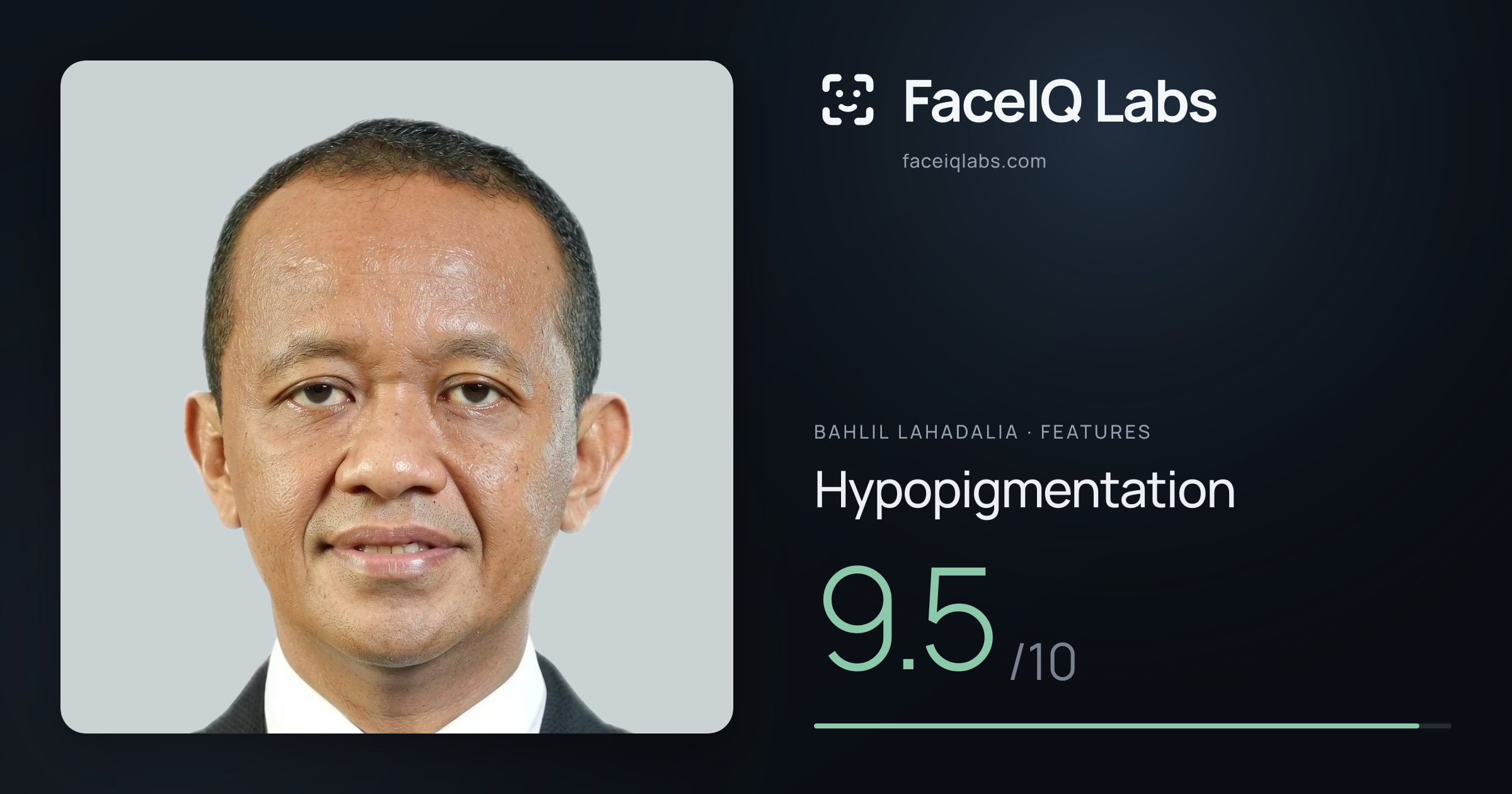 Bahlil Lahadalia Hypopigmentation: 9.5/10, drawn on the photo