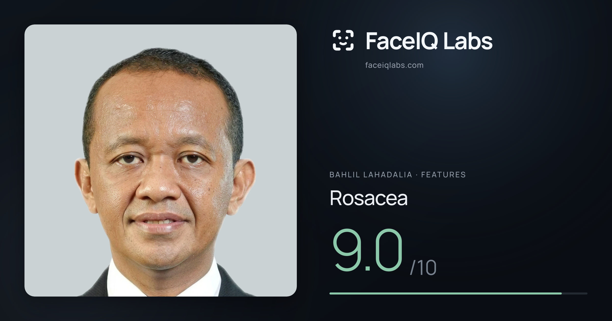 Bahlil Lahadalia Rosacea: 9.0/10, drawn on the photo