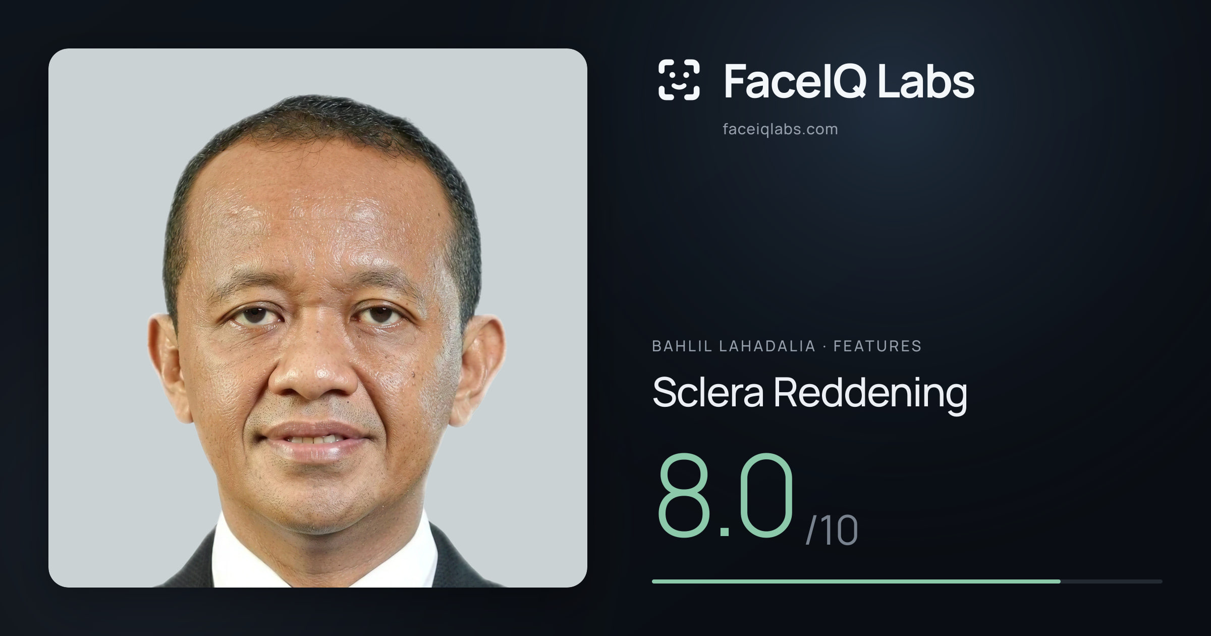 Bahlil Lahadalia Sclera Reddening: 8.0/10, drawn on the photo