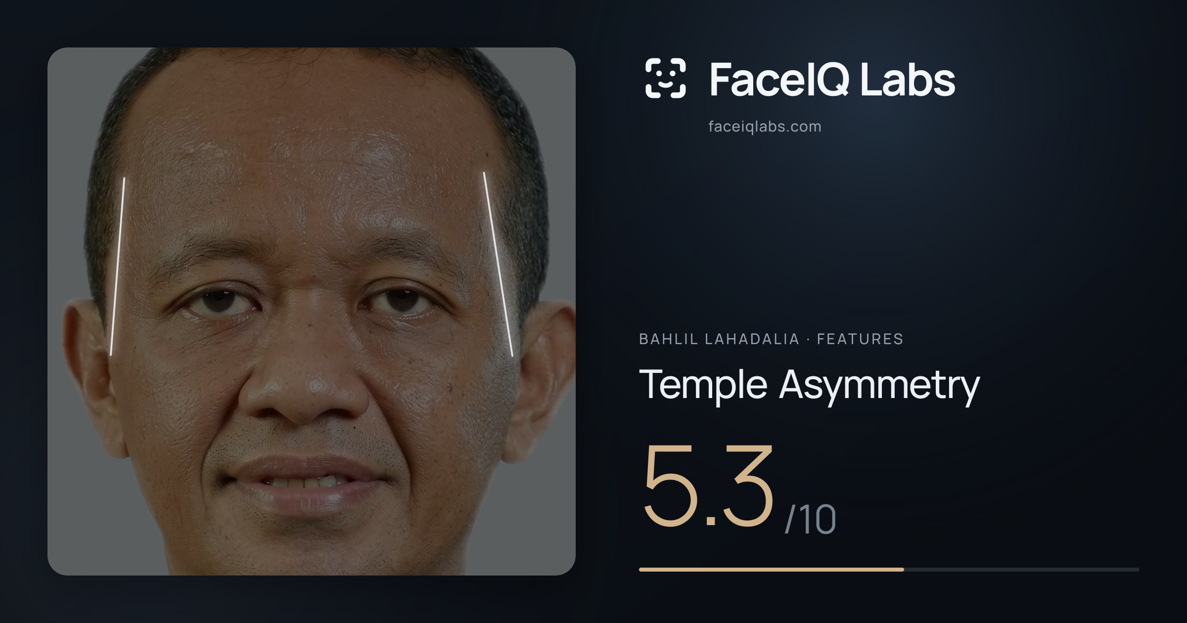 Bahlil Lahadalia Temple Asymmetry: 5.3/10, drawn on the photo