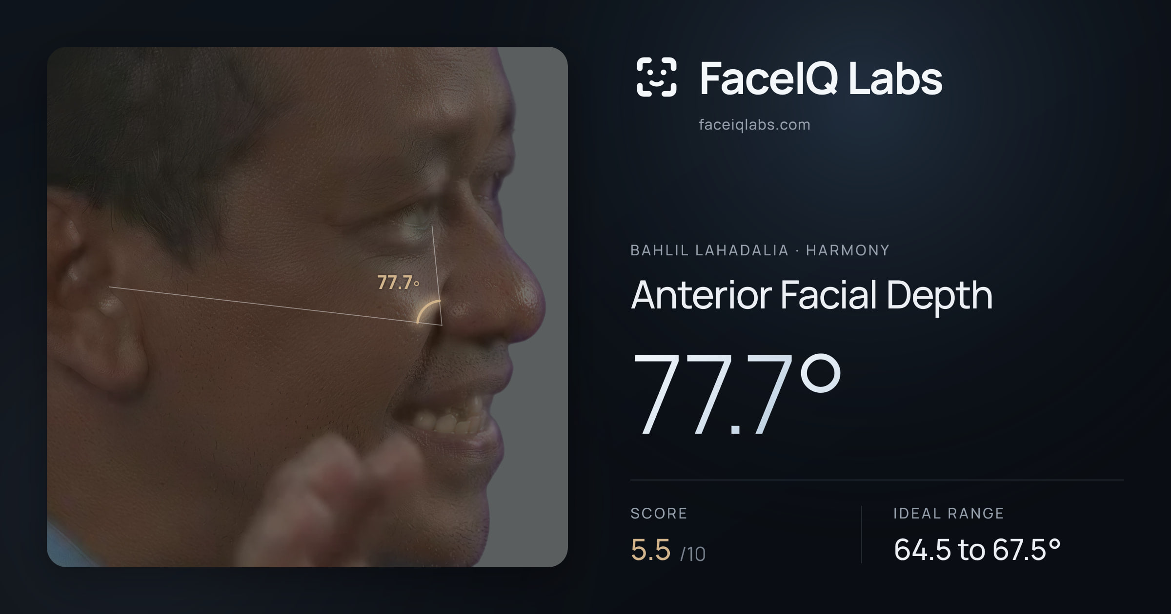 Bahlil Lahadalia Anterior Facial Depth: 77.7°, drawn on the photo