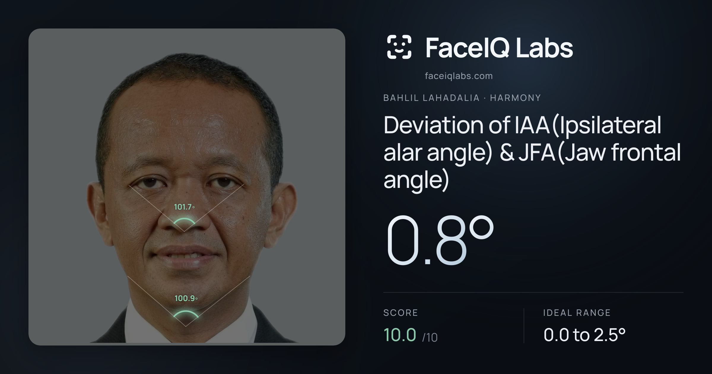 Bahlil Lahadalia Deviation of IAA(Ipsilateral alar angle) & JFA(Jaw frontal angle): 0.8°, drawn on the photo