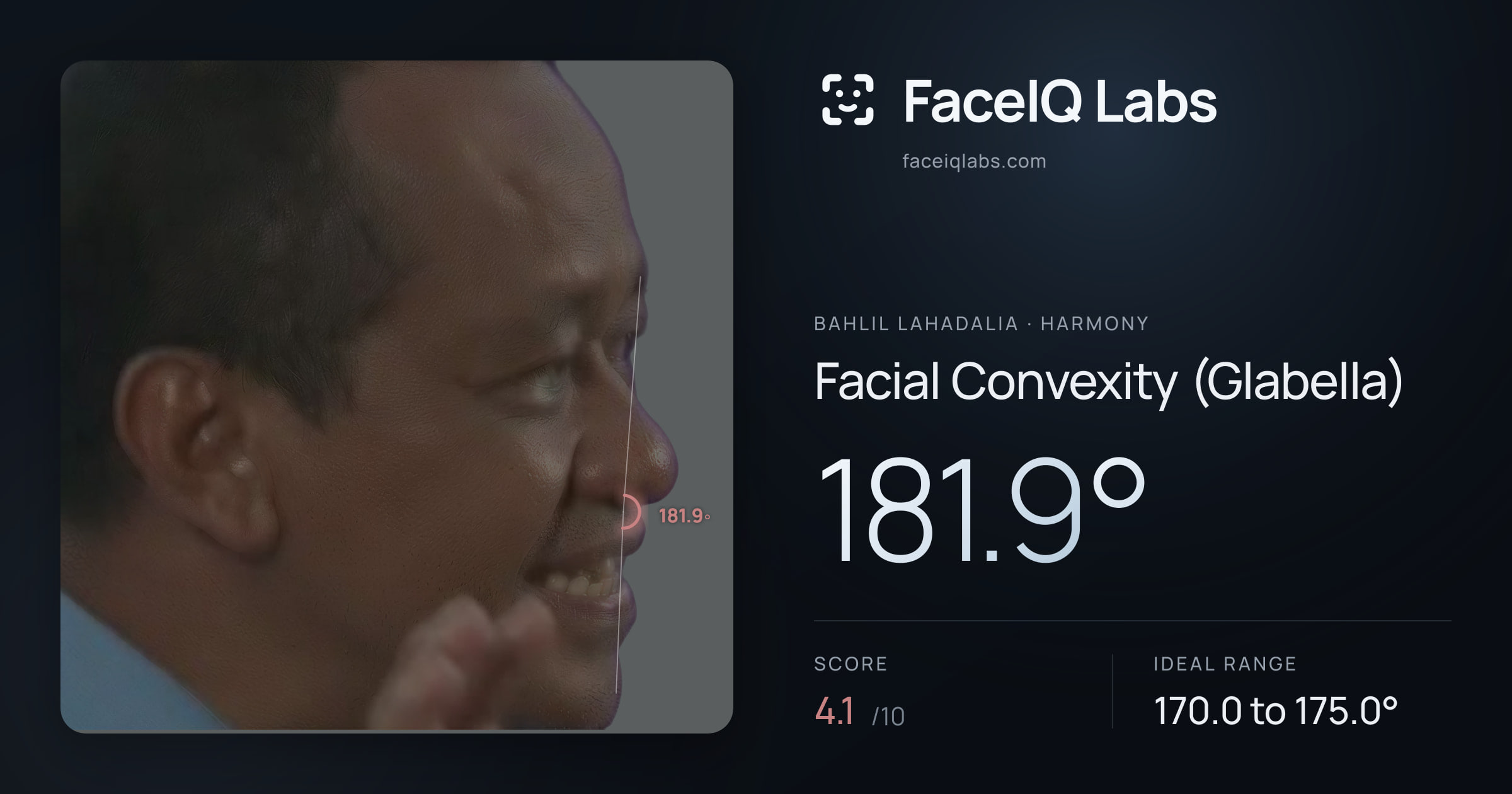 Bahlil Lahadalia Facial Convexity (Glabella): 181.9°, drawn on the photo