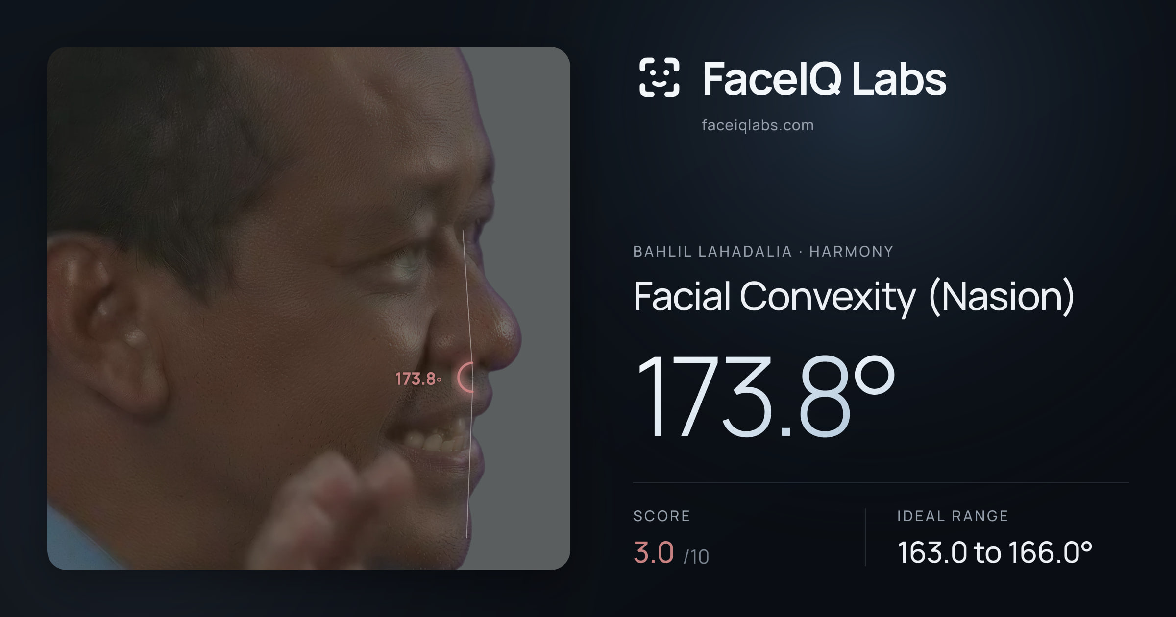 Bahlil Lahadalia Facial Convexity (Nasion): 173.8°, drawn on the photo