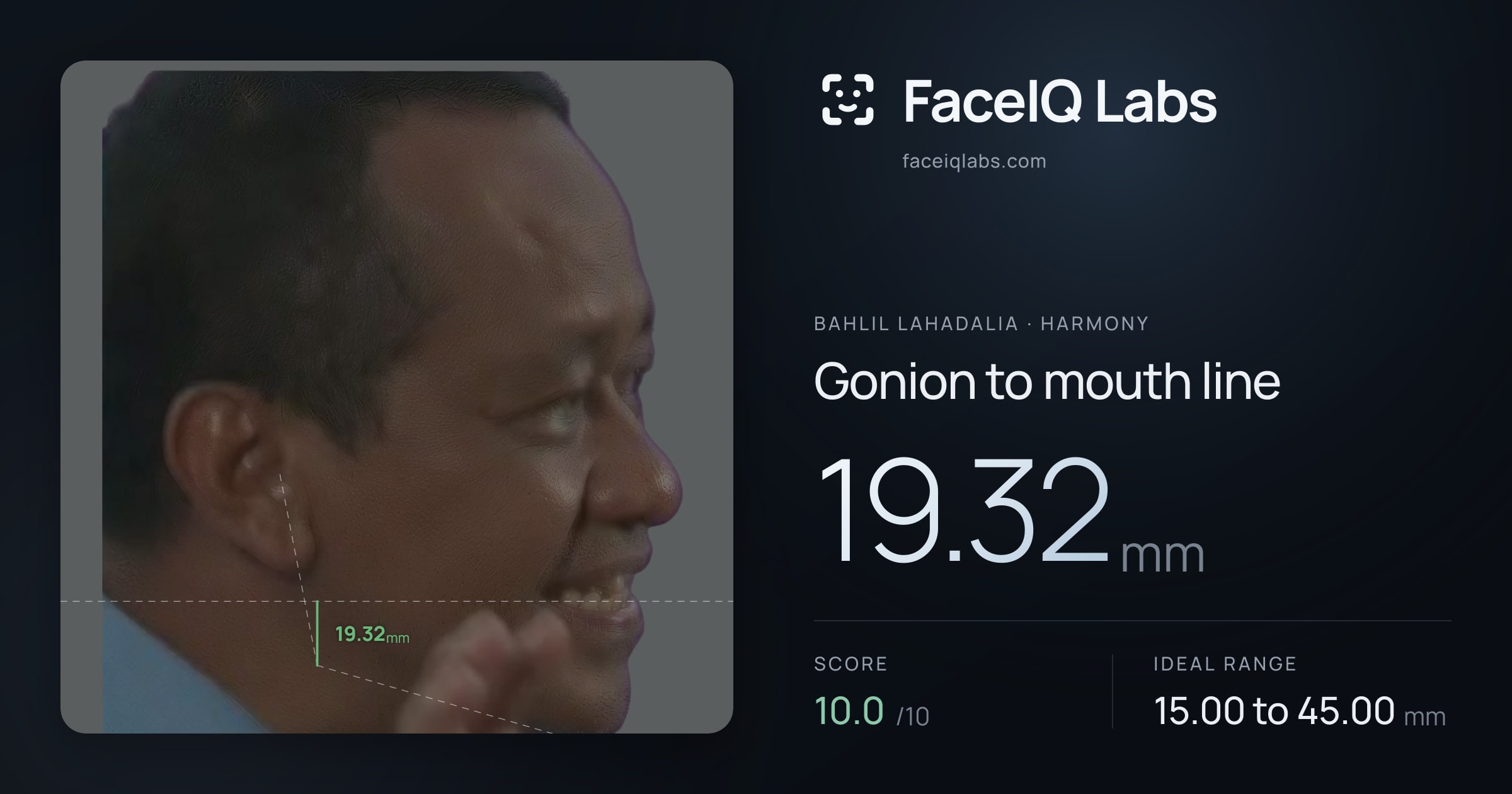 Bahlil Lahadalia Gonion to mouth line: 19.32mm, drawn on the photo
