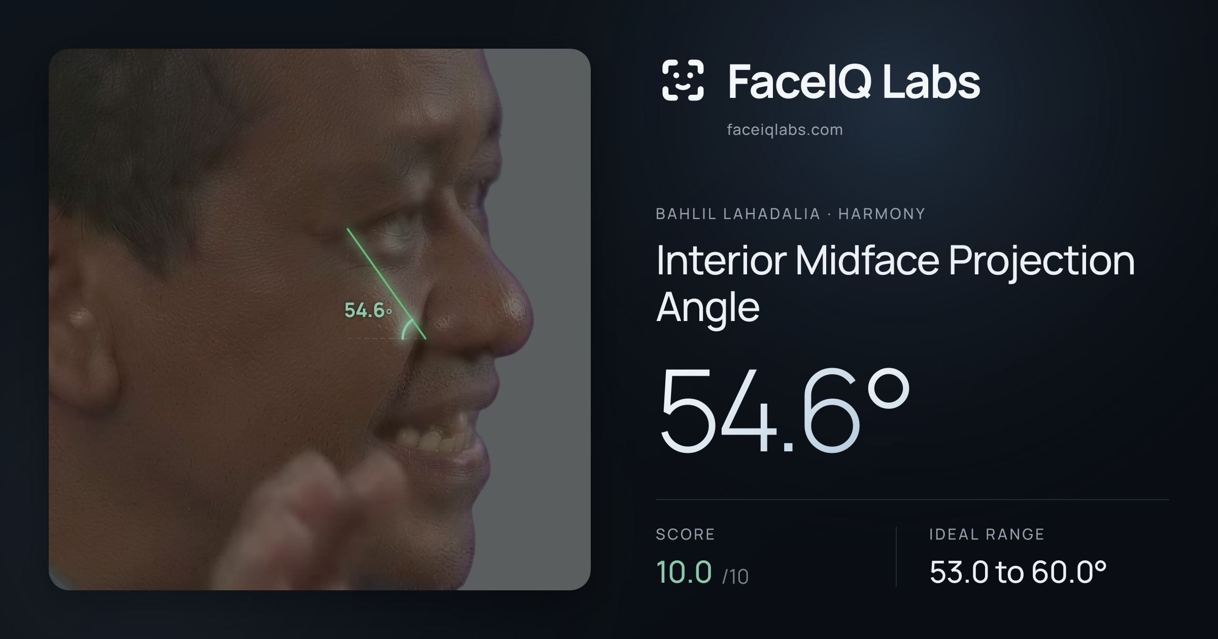 Bahlil Lahadalia Interior Midface Projection Angle: 54.6°, drawn on the photo