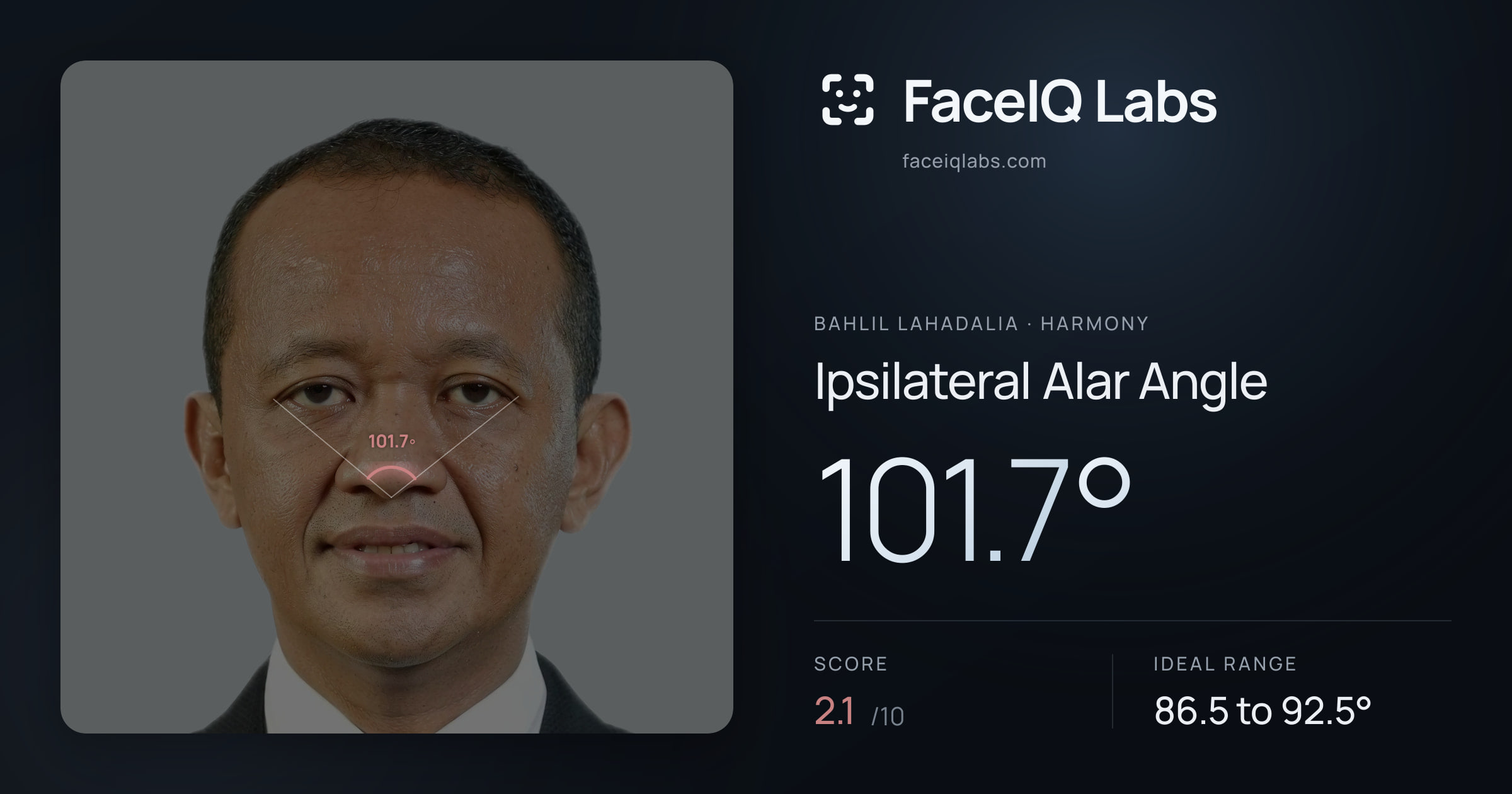 Bahlil Lahadalia Ipsilateral Alar Angle: 101.7°, drawn on the photo