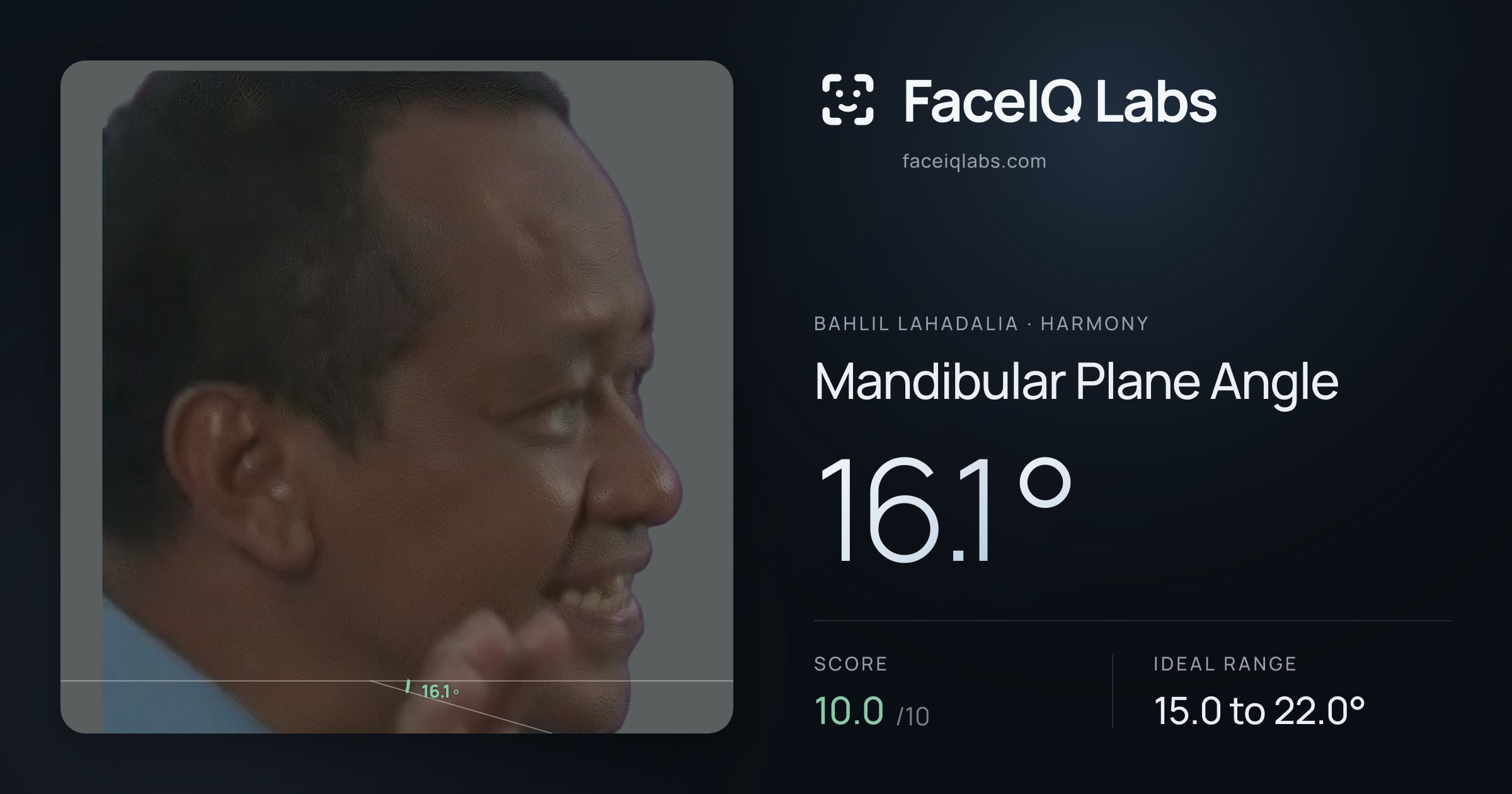 Bahlil Lahadalia Mandibular Plane Angle: 16.1°, drawn on the photo