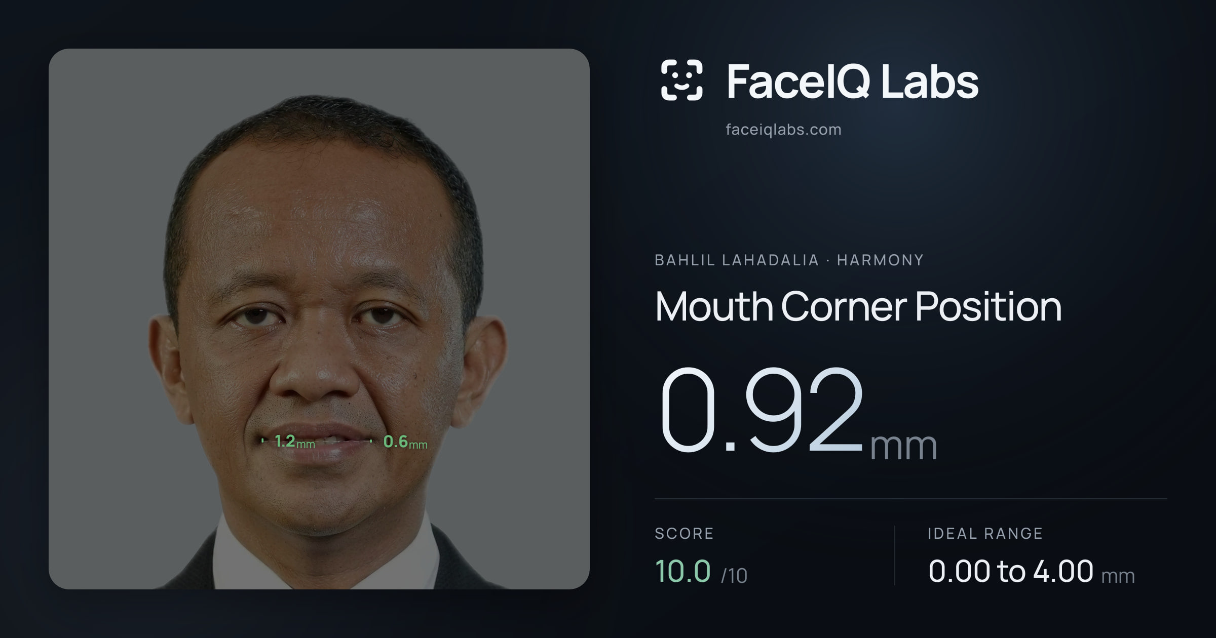 Bahlil Lahadalia Mouth Corner Position: 0.92mm, drawn on the photo