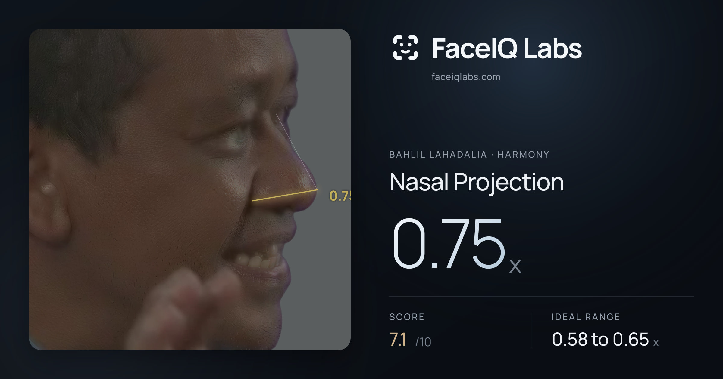 Bahlil Lahadalia Nasal Projection: 0.75x, drawn on the photo