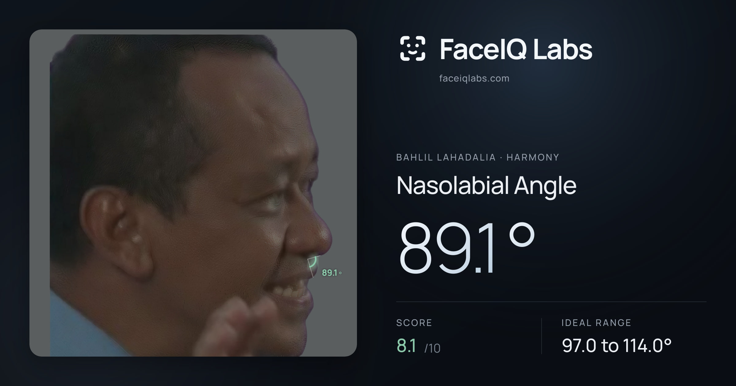 Bahlil Lahadalia Nasolabial Angle: 89.1°, drawn on the photo