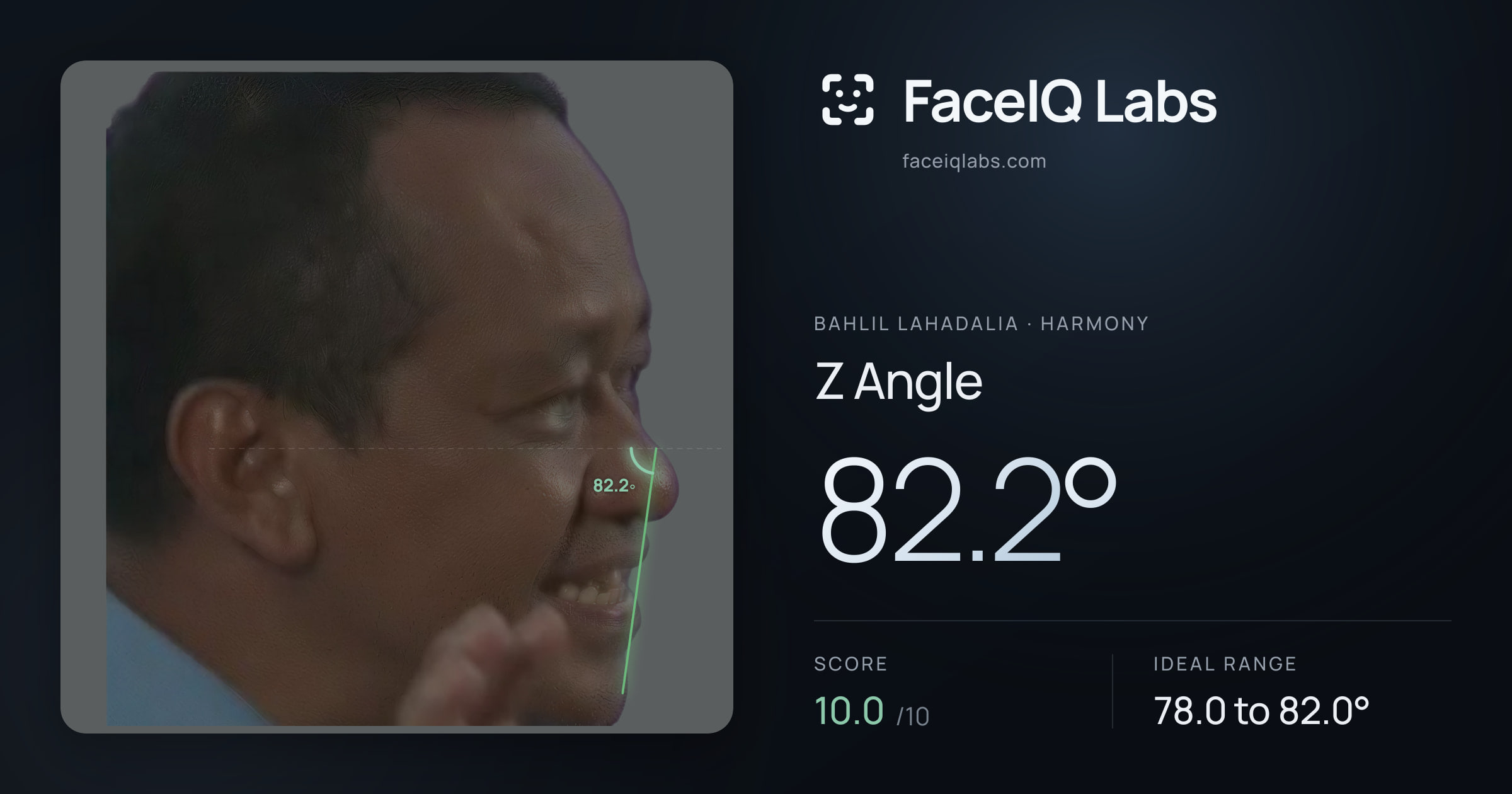Bahlil Lahadalia Z Angle: 82.2°, drawn on the photo