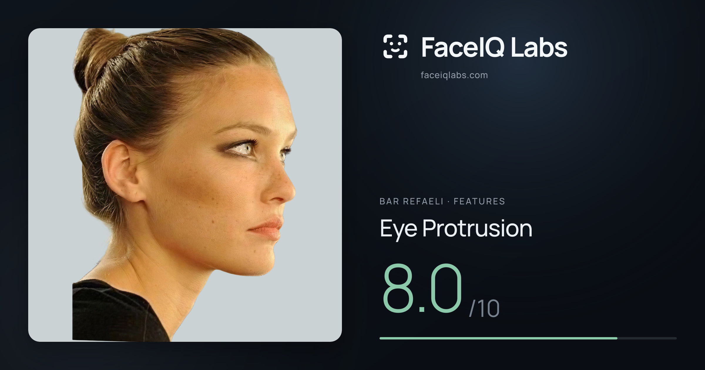 Bar Refaeli Eye Protrusion: 8.0/10, drawn on the photo