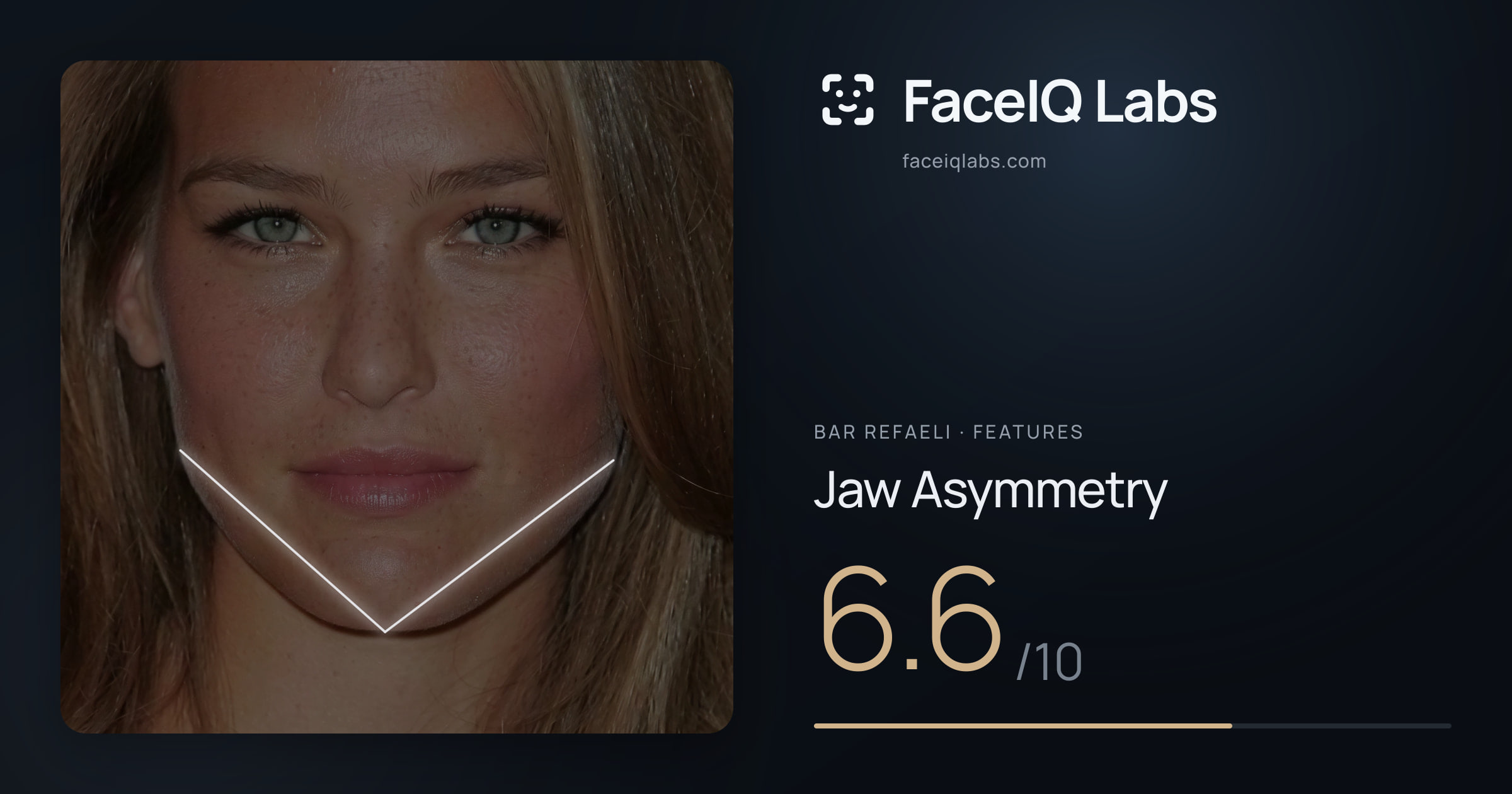 Bar Refaeli Jaw Asymmetry: 6.6/10, drawn on the photo