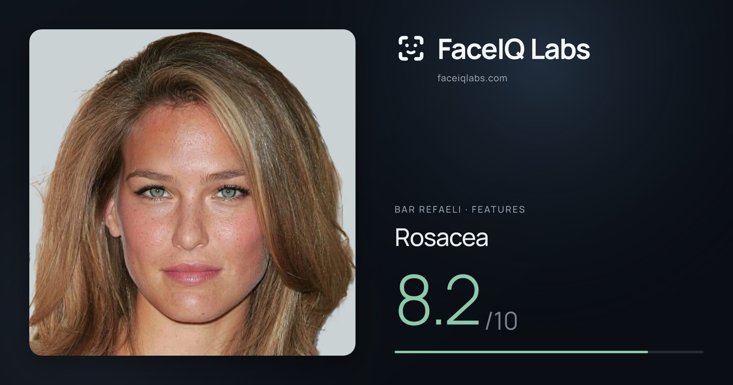 Bar Refaeli Rosacea: 8.2/10, drawn on the photo