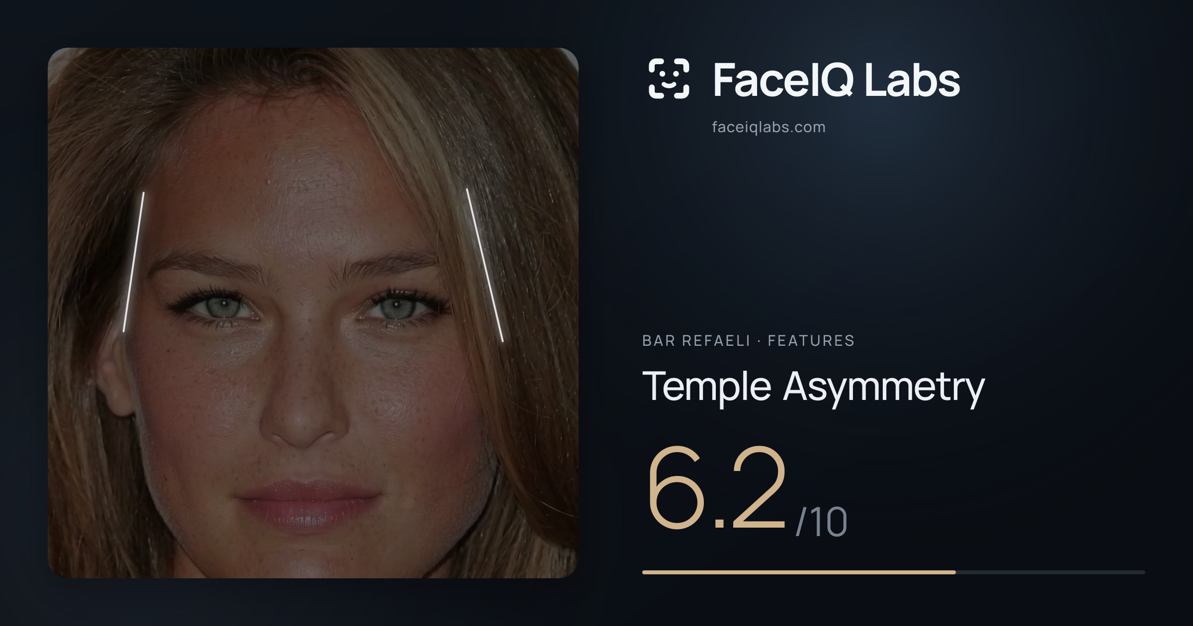 Bar Refaeli Temple Asymmetry: 6.2/10, drawn on the photo