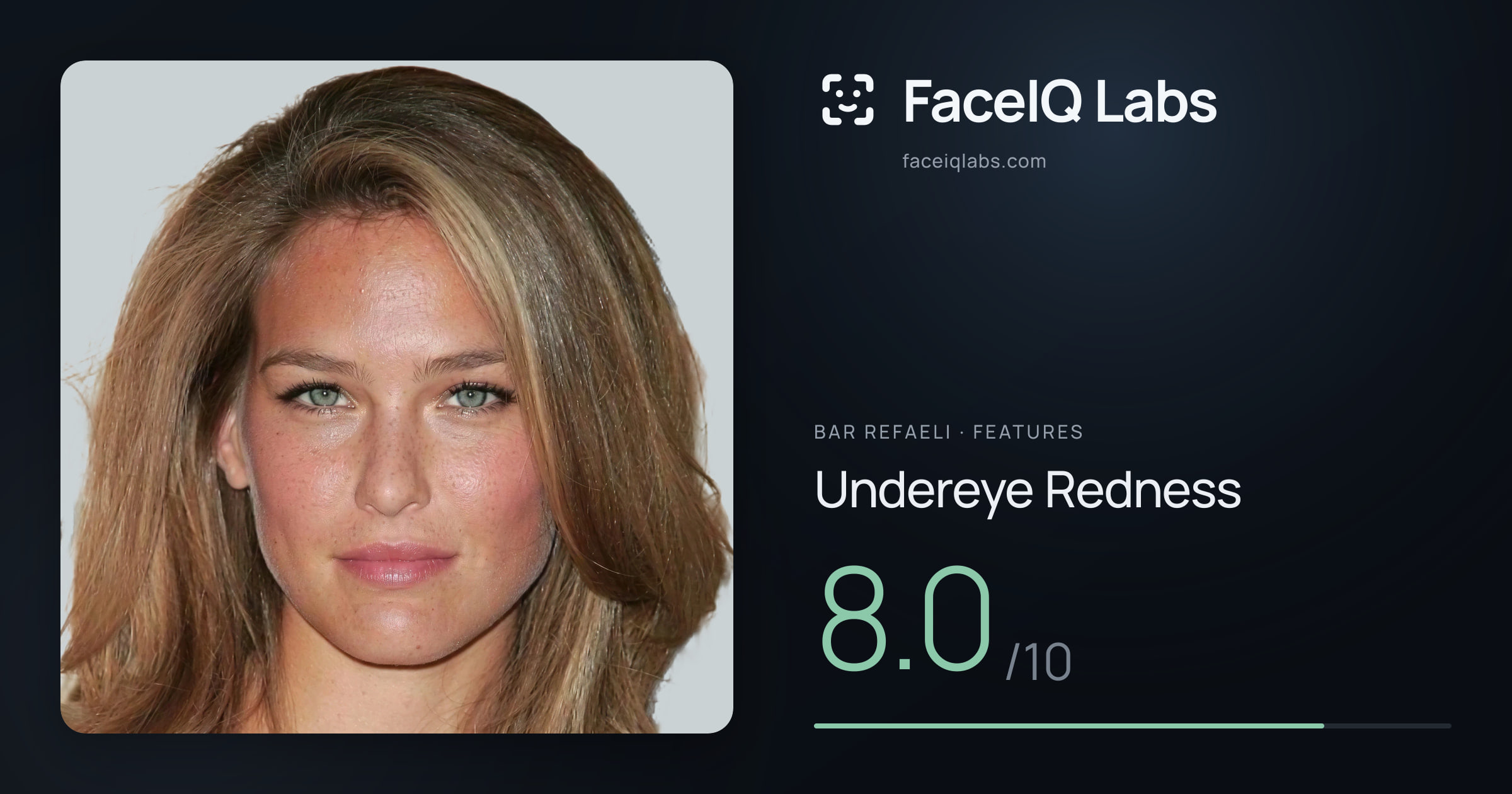 Bar Refaeli Undereye Redness: 8.0/10, drawn on the photo