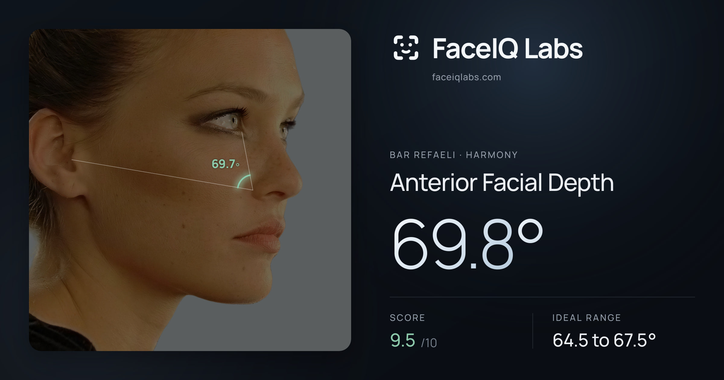 Bar Refaeli Anterior Facial Depth: 69.8°, drawn on the photo