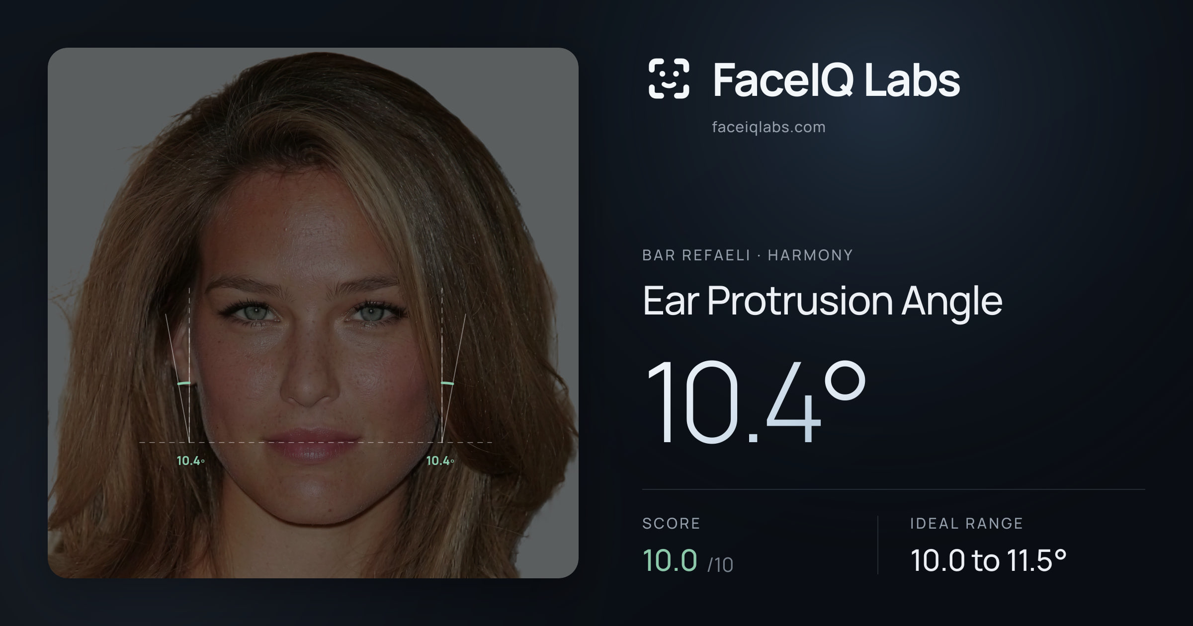 Bar Refaeli Ear Protrusion Angle: 10.4°, drawn on the photo