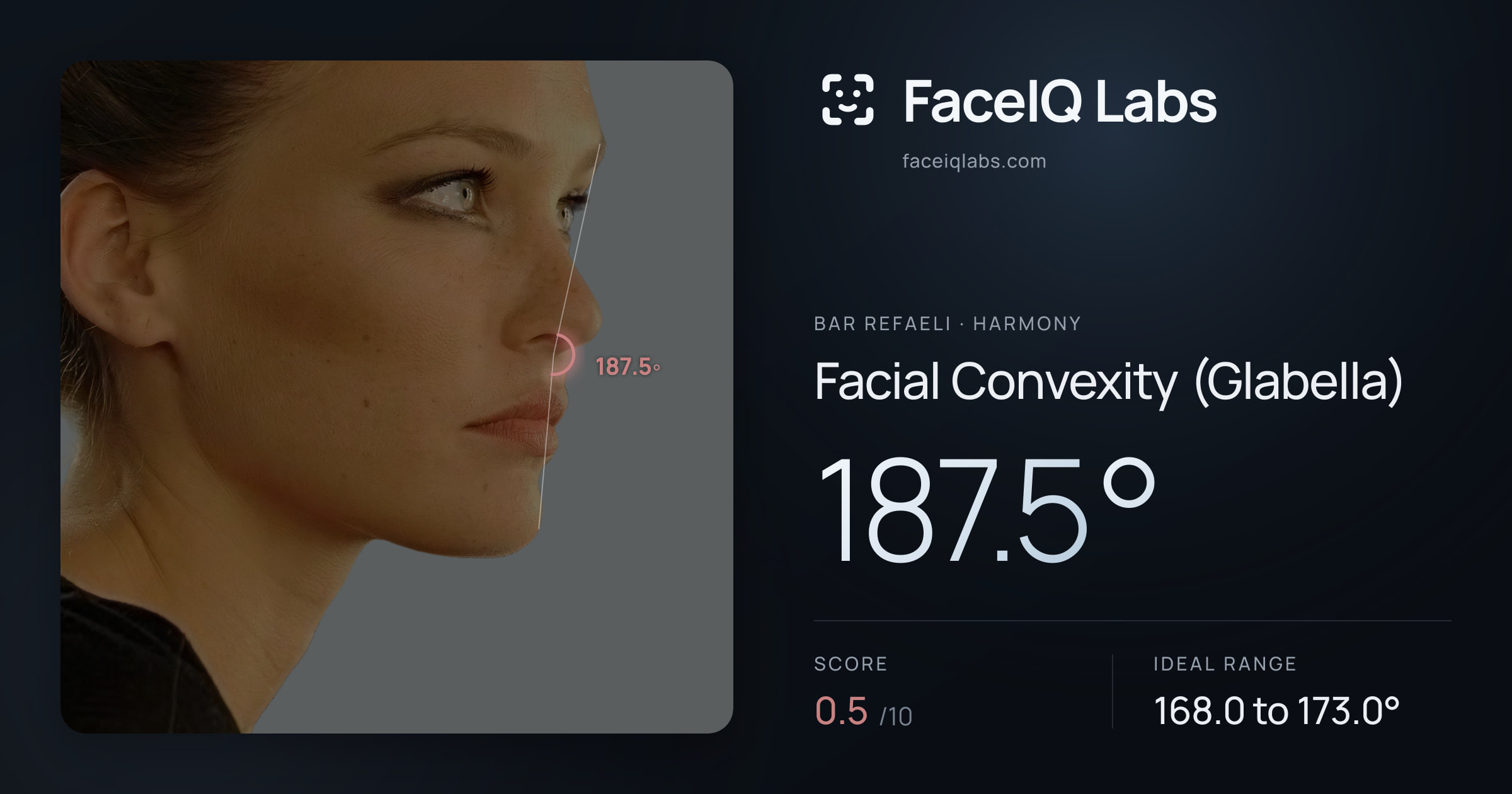 Bar Refaeli Facial Convexity (Glabella): 187.5°, drawn on the photo