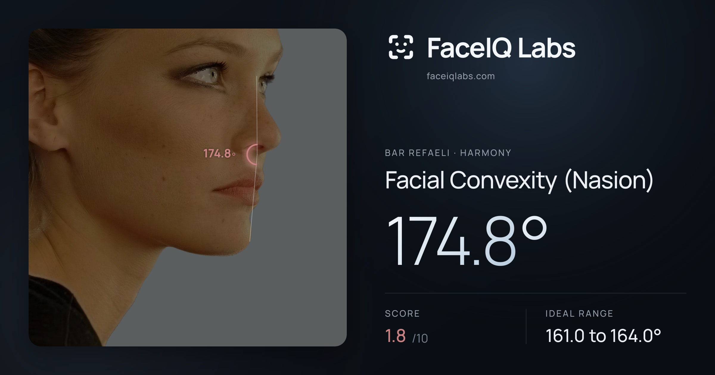Bar Refaeli Facial Convexity (Nasion): 174.8°, drawn on the photo