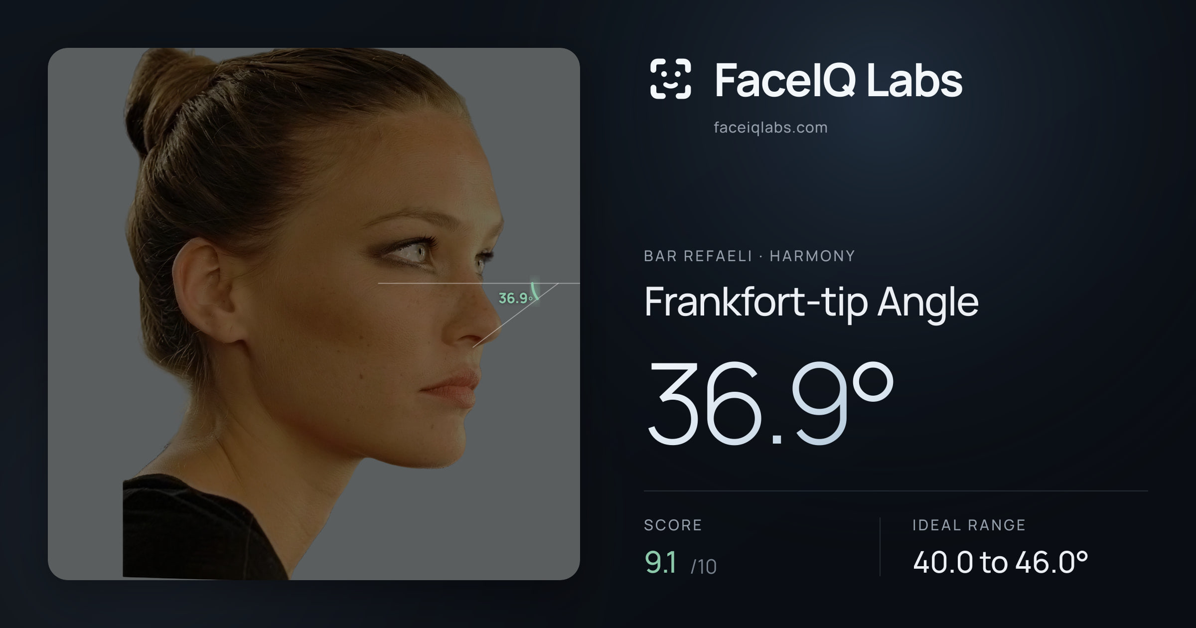 Bar Refaeli Frankfort-tip Angle: 36.9°, drawn on the photo