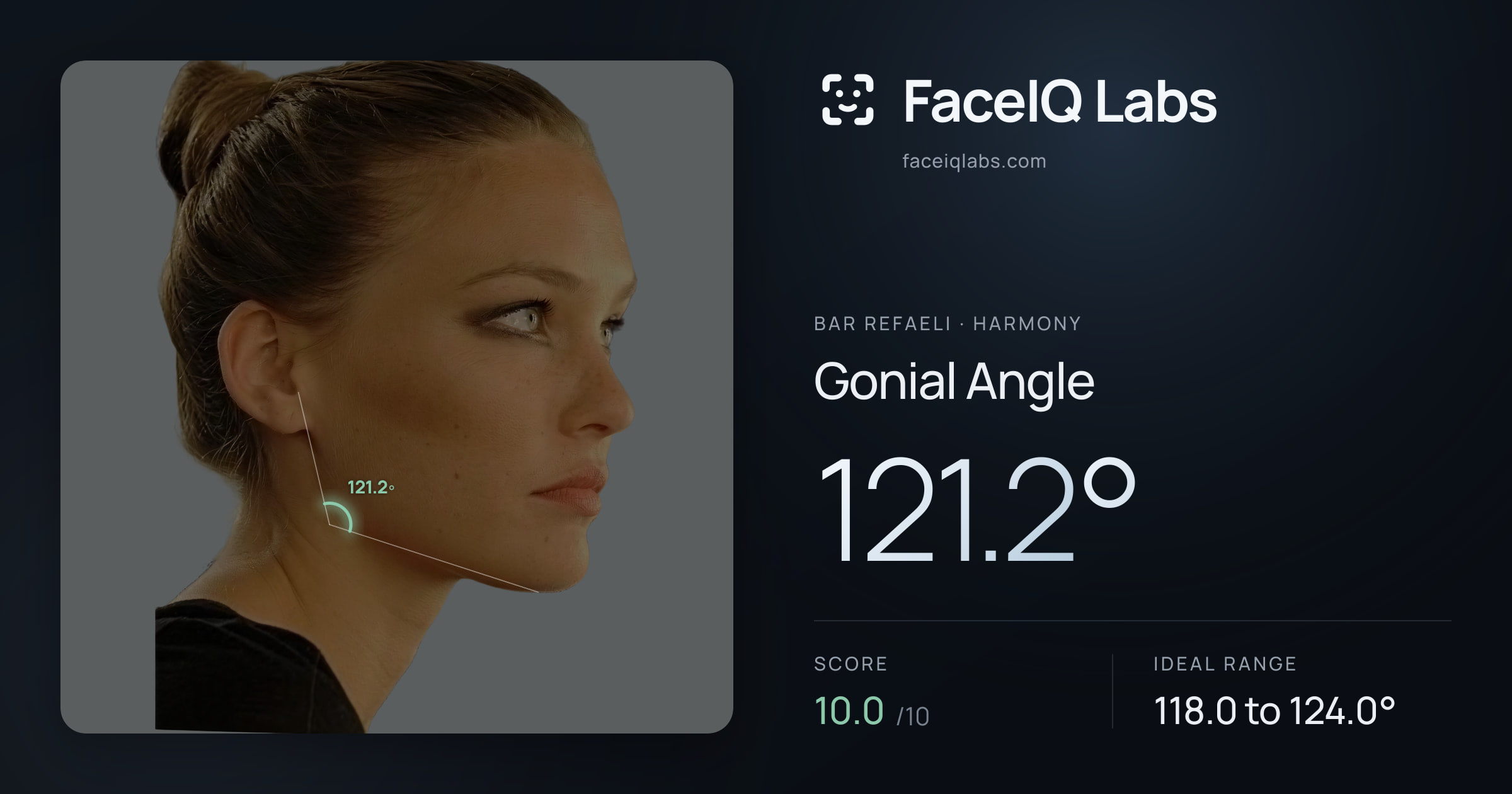Bar Refaeli Gonial Angle: 121.2°, drawn on the photo
