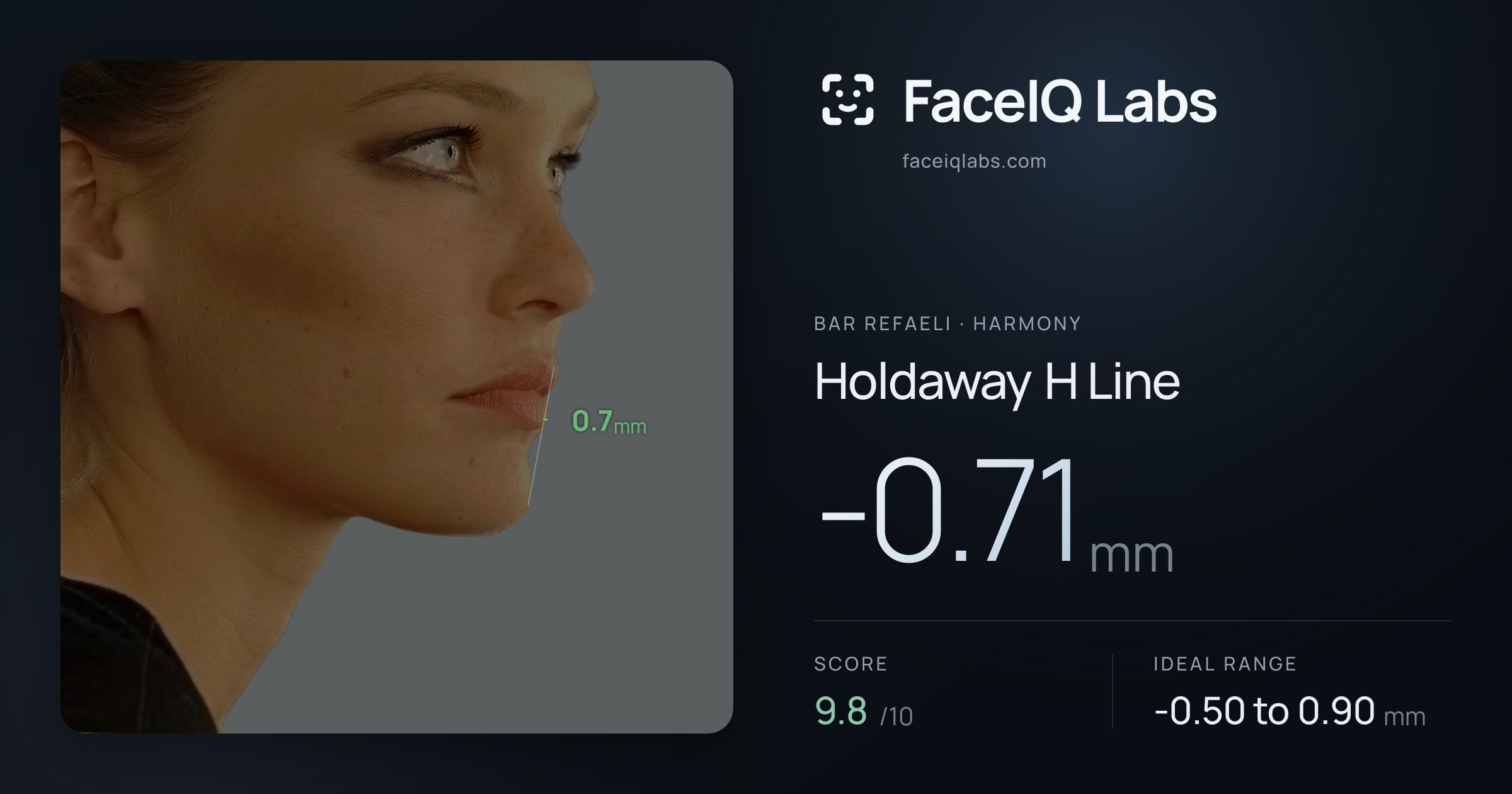 Bar Refaeli Holdaway H Line: -0.71mm, drawn on the photo