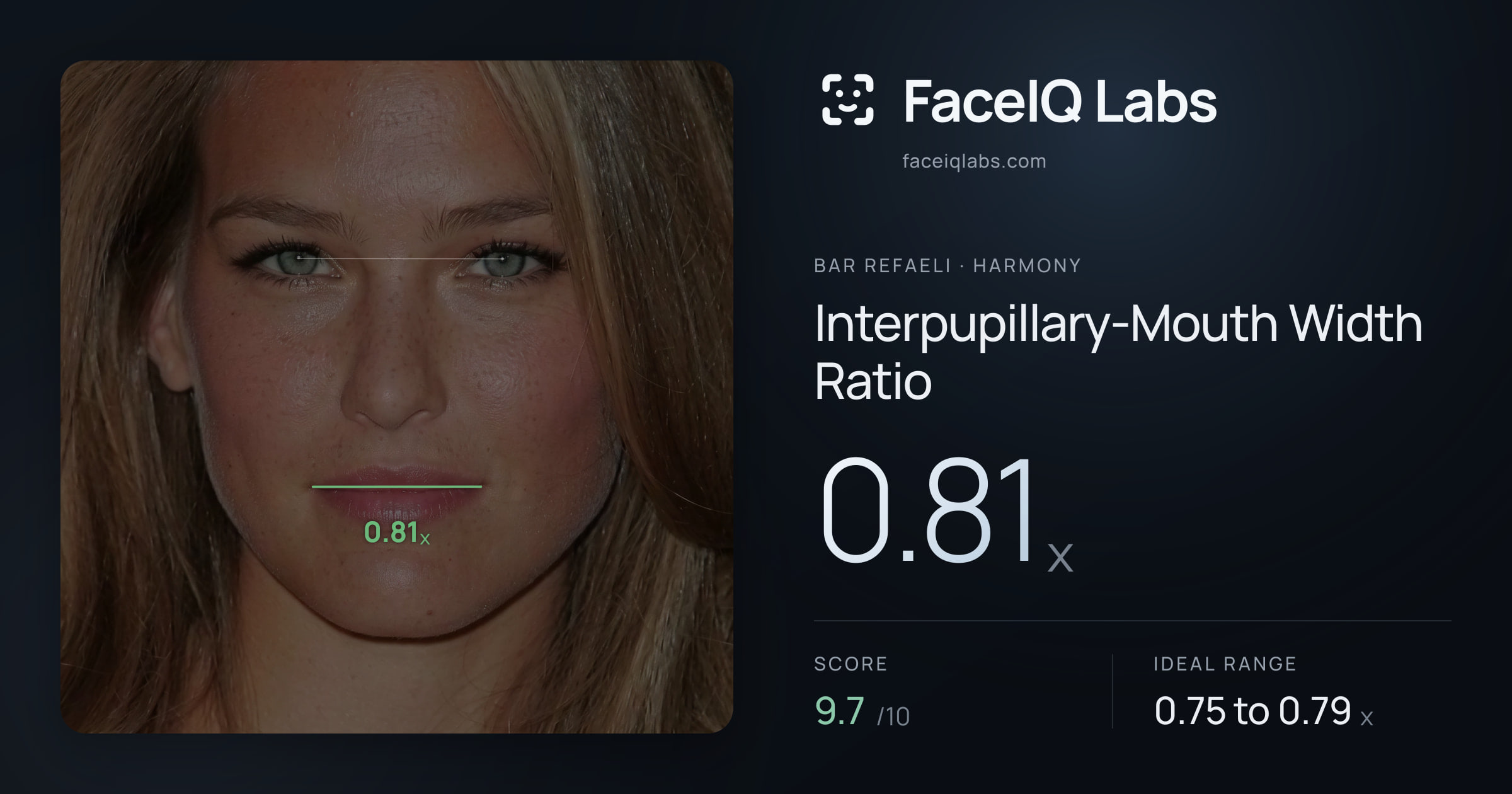 Bar Refaeli Interpupillary-Mouth Width Ratio: 0.81x, drawn on the photo