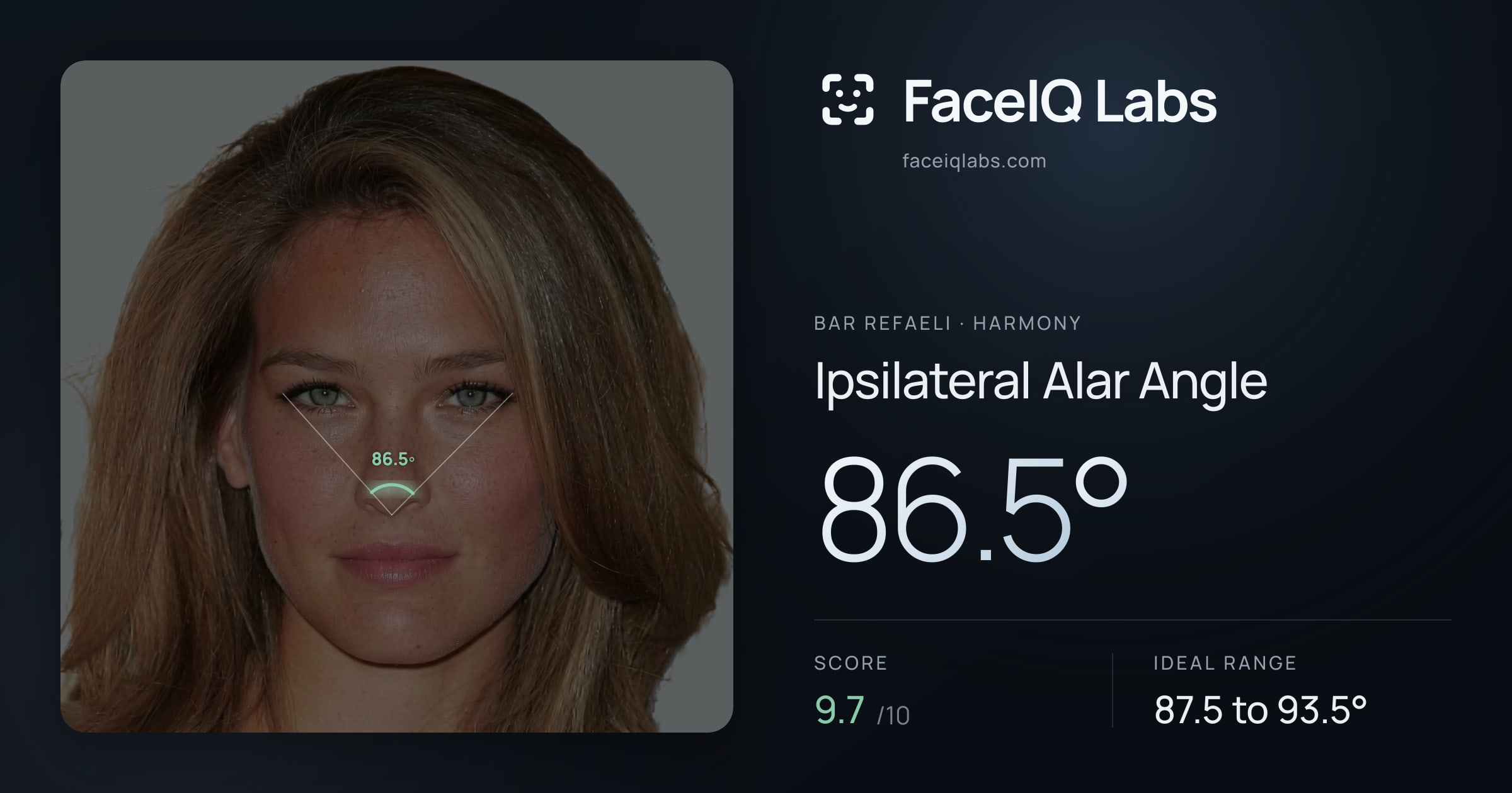 Bar Refaeli Ipsilateral Alar Angle: 86.5°, drawn on the photo