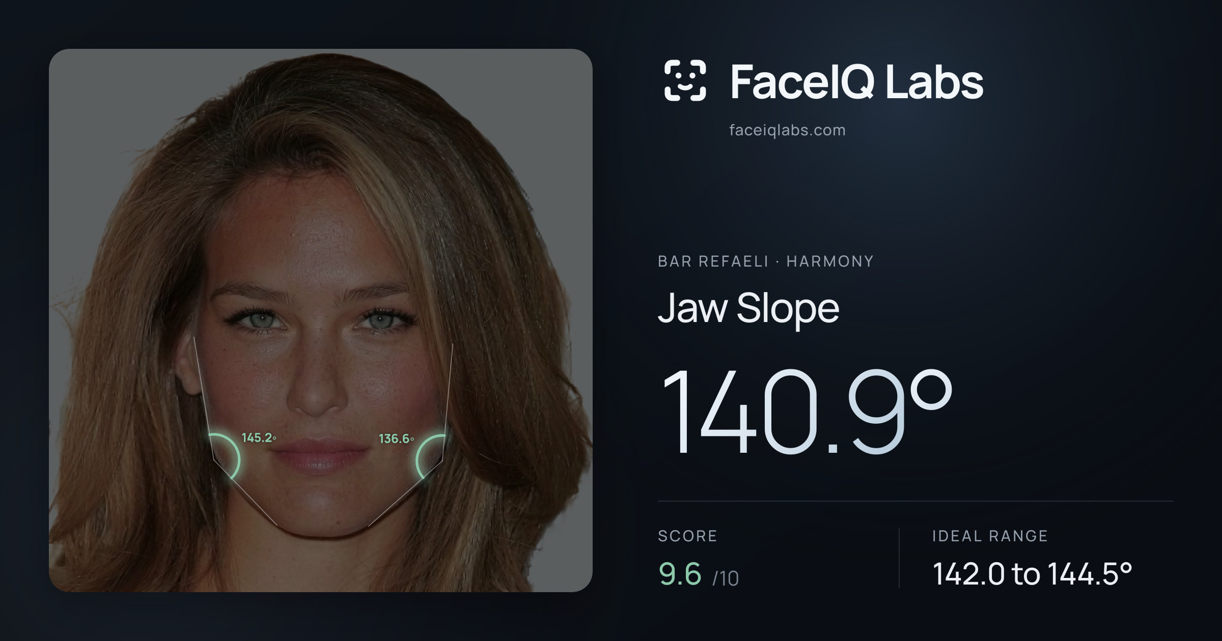 Bar Refaeli Jaw Slope: 140.9°, drawn on the photo