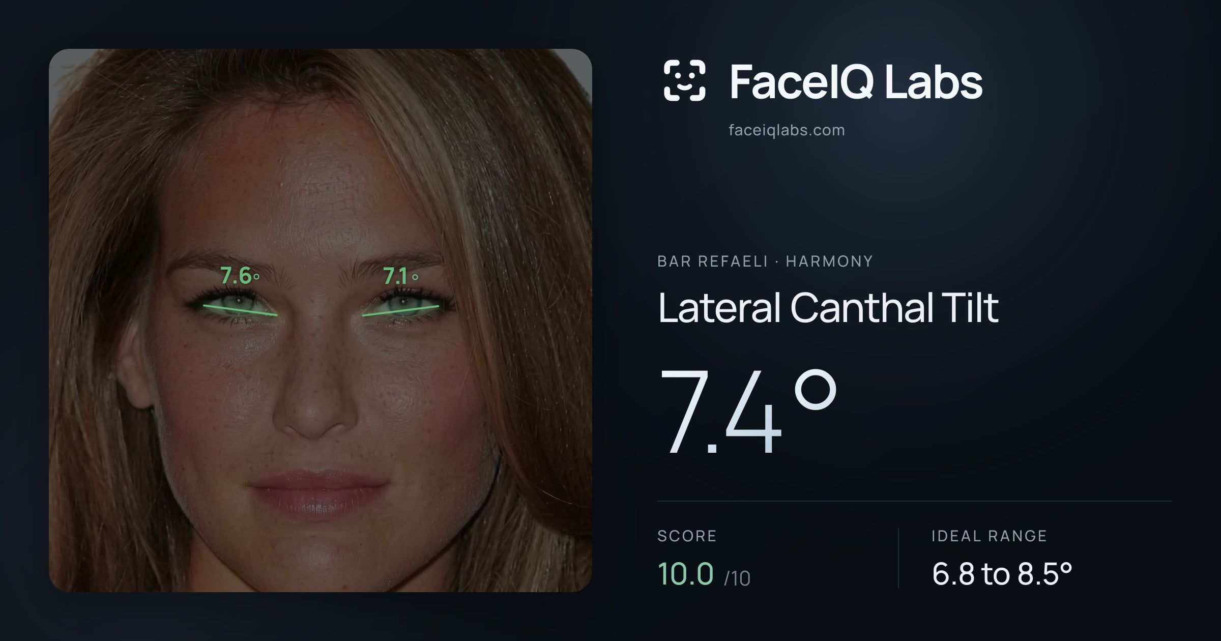 Bar Refaeli Lateral Canthal Tilt: 7.4°, drawn on the photo
