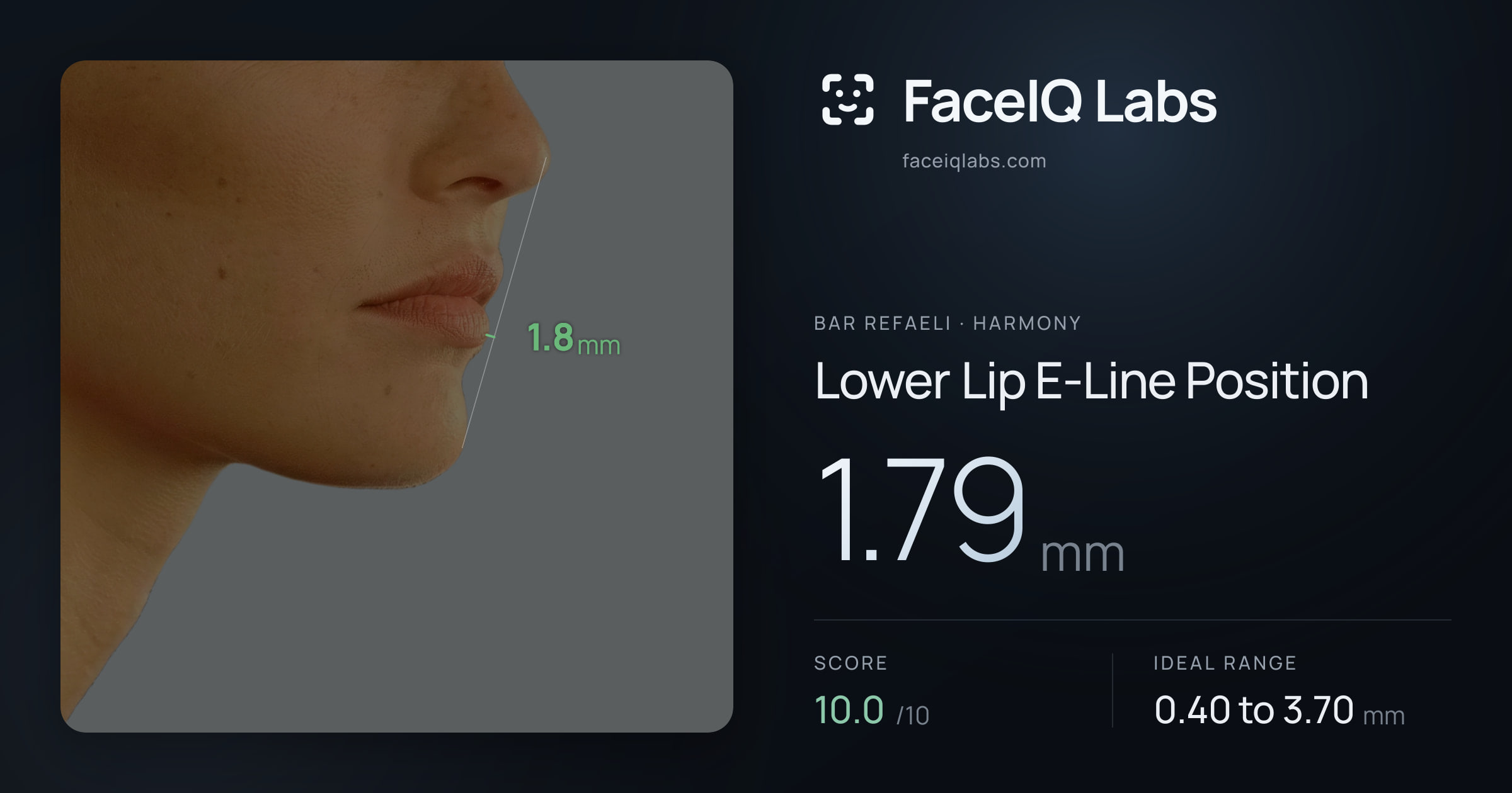 Bar Refaeli Lower Lip E-Line Position: 1.79mm, drawn on the photo