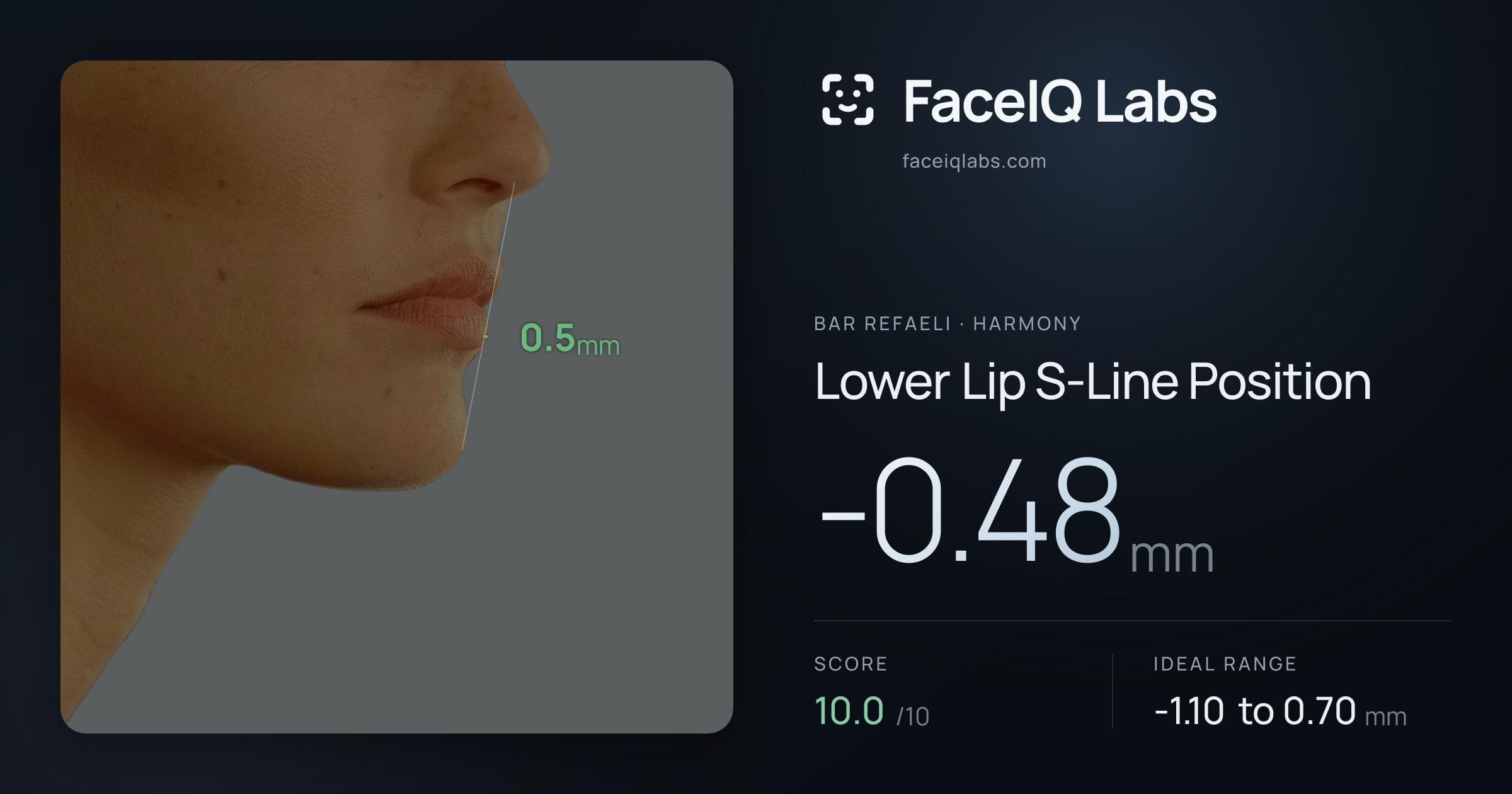 Bar Refaeli Lower Lip S-Line Position: -0.48mm, drawn on the photo