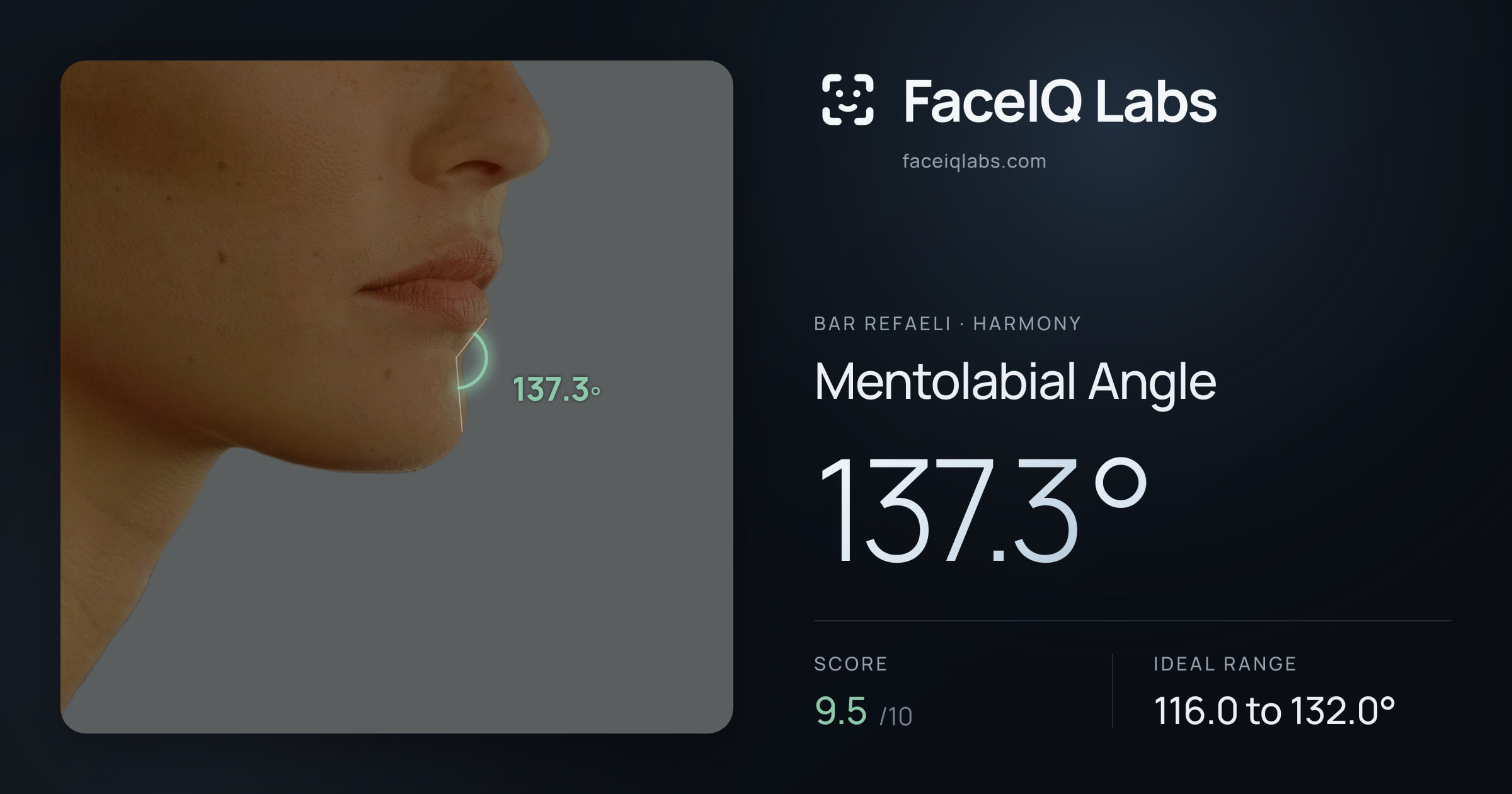 Bar Refaeli Mentolabial Angle: 137.3°, drawn on the photo